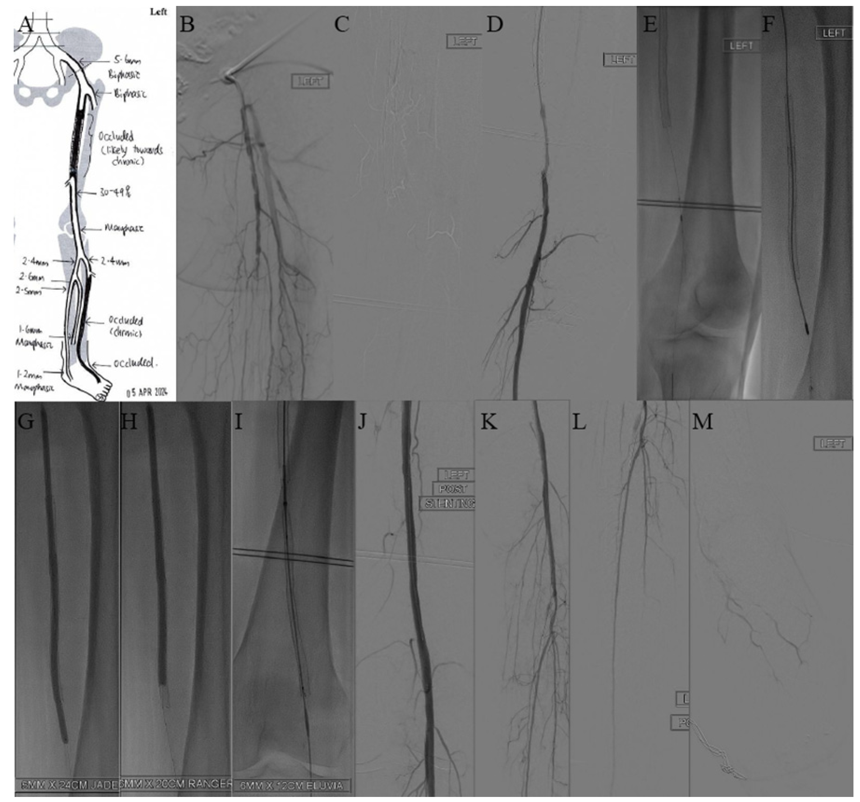 Jcm 14 01437 g003 Jcm 14 01437 g003