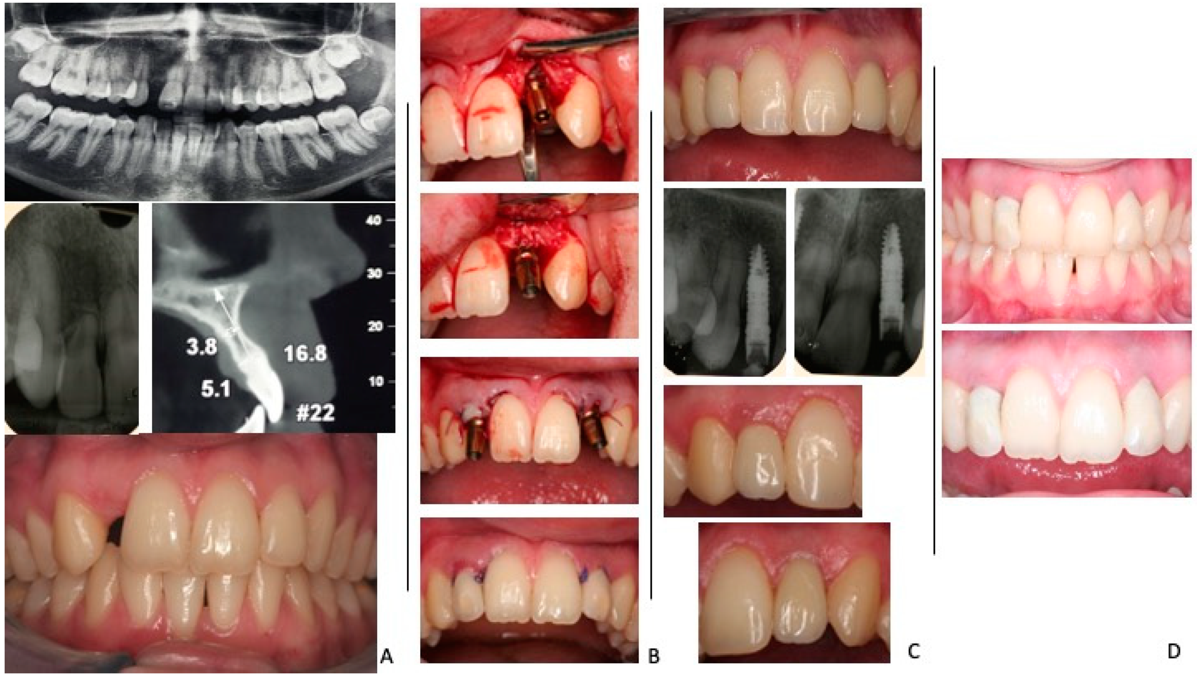 Jcm 14 01442 g002 Jcm 14 01442 g002