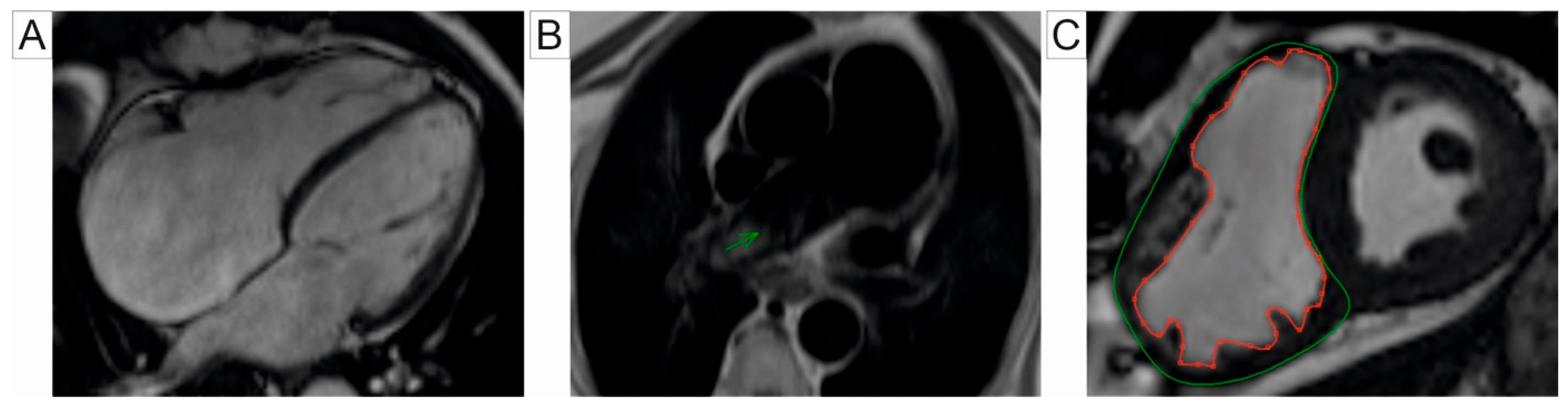 Jcm 14 01473 g002 Jcm 14 01473 g002