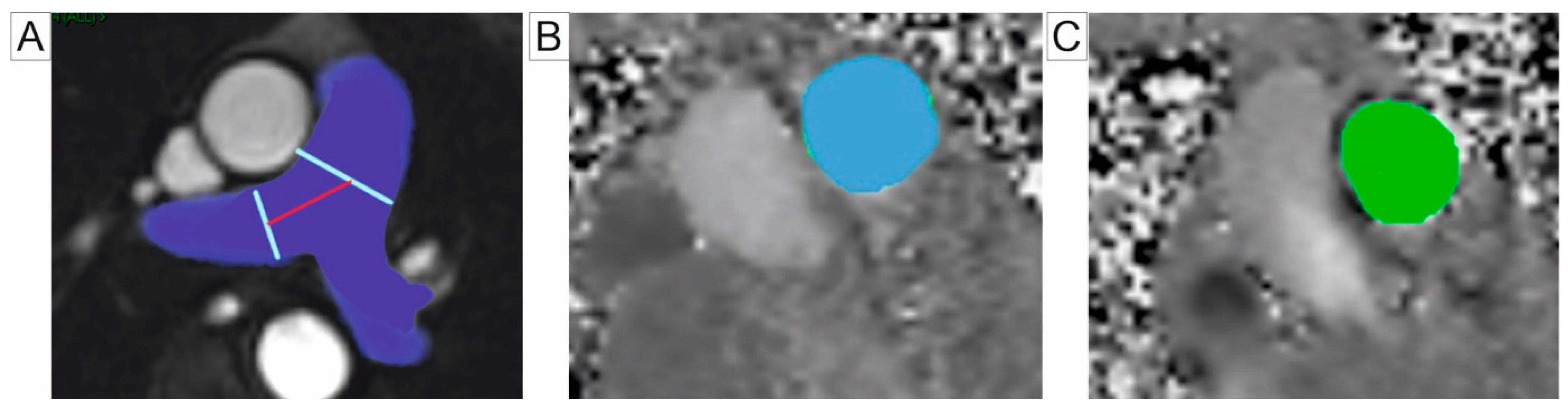 Jcm 14 01473 g003 Jcm 14 01473 g003