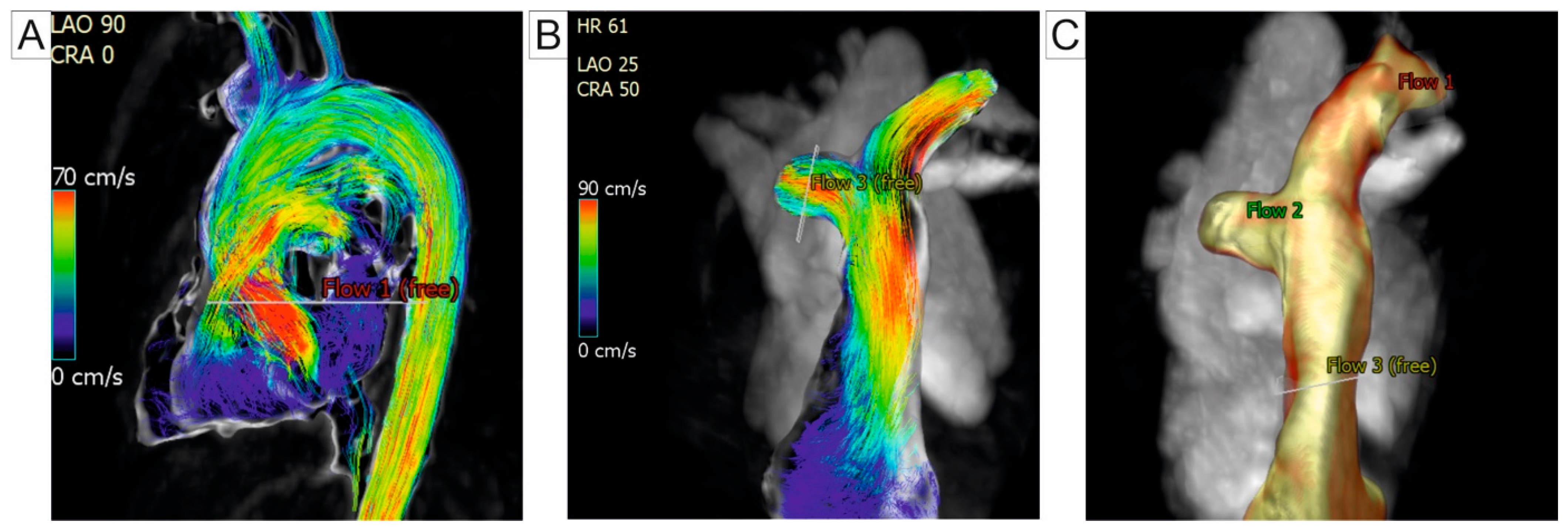 Jcm 14 01473 g004 Jcm 14 01473 g004