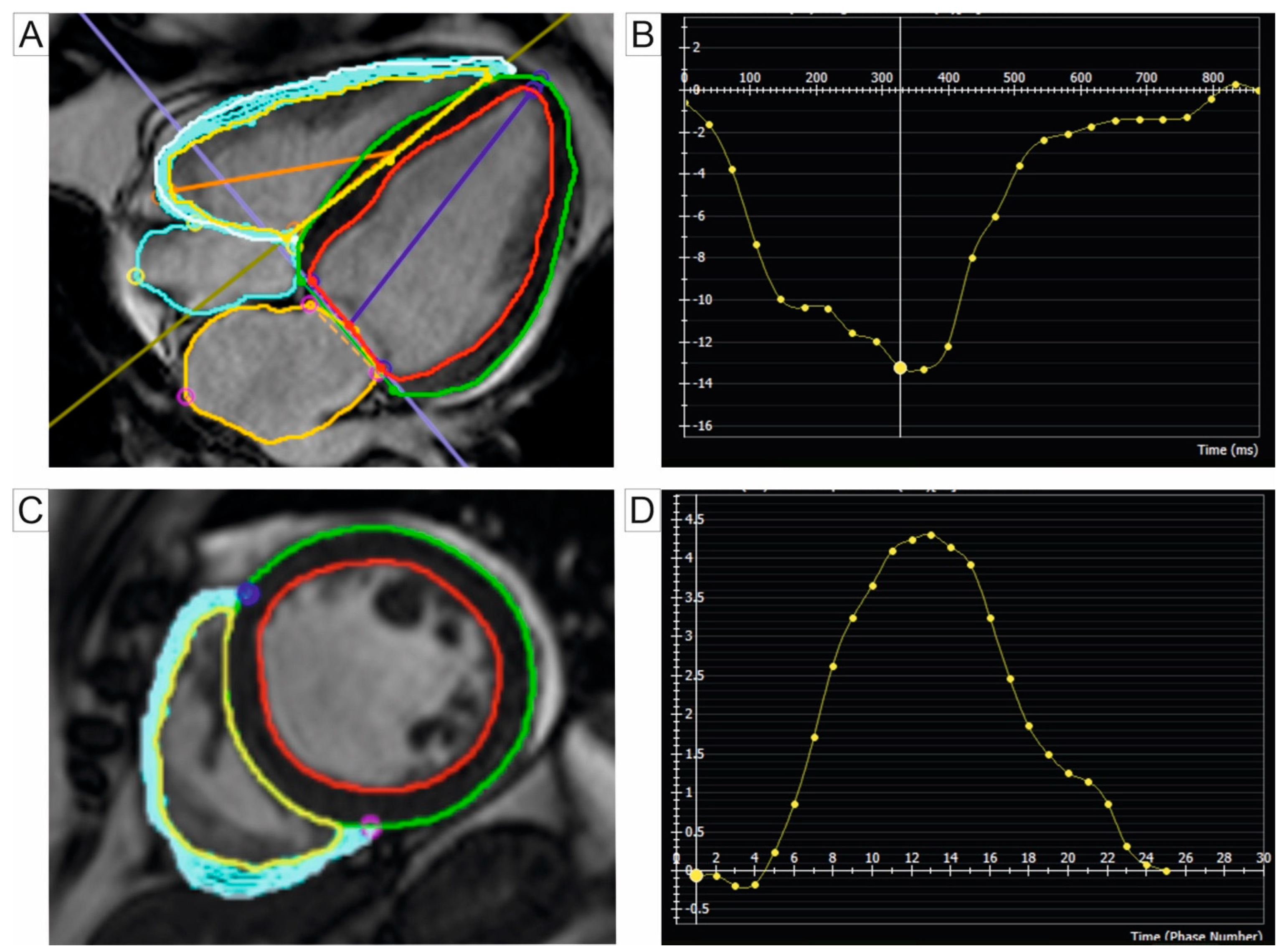 Jcm 14 01473 g006 Jcm 14 01473 g006