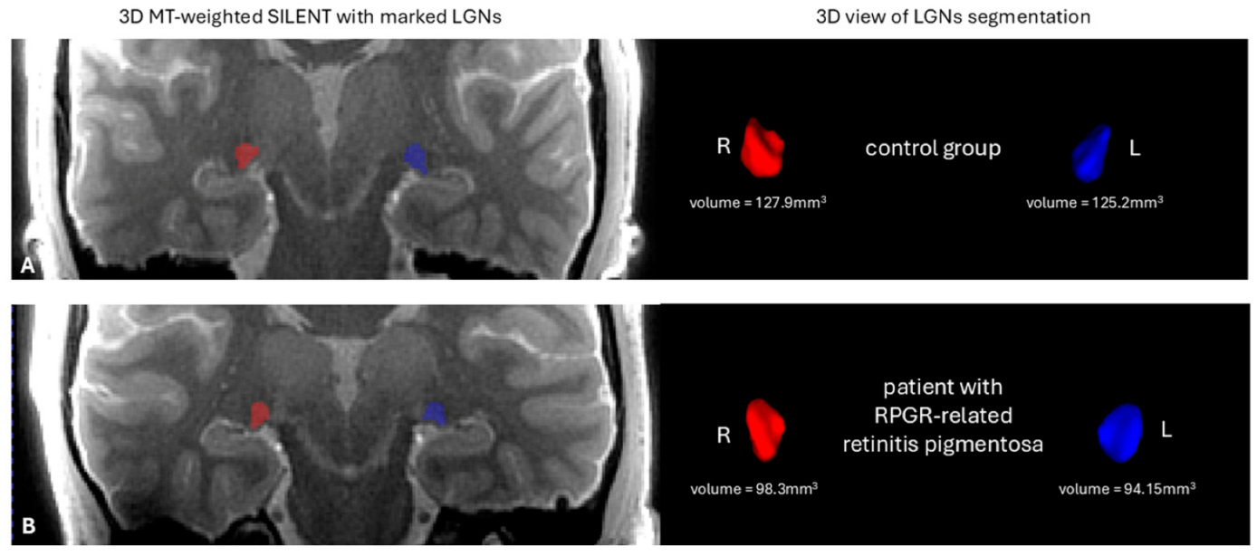 Jcm 14 01617 g004 Jcm 14 01617 g004