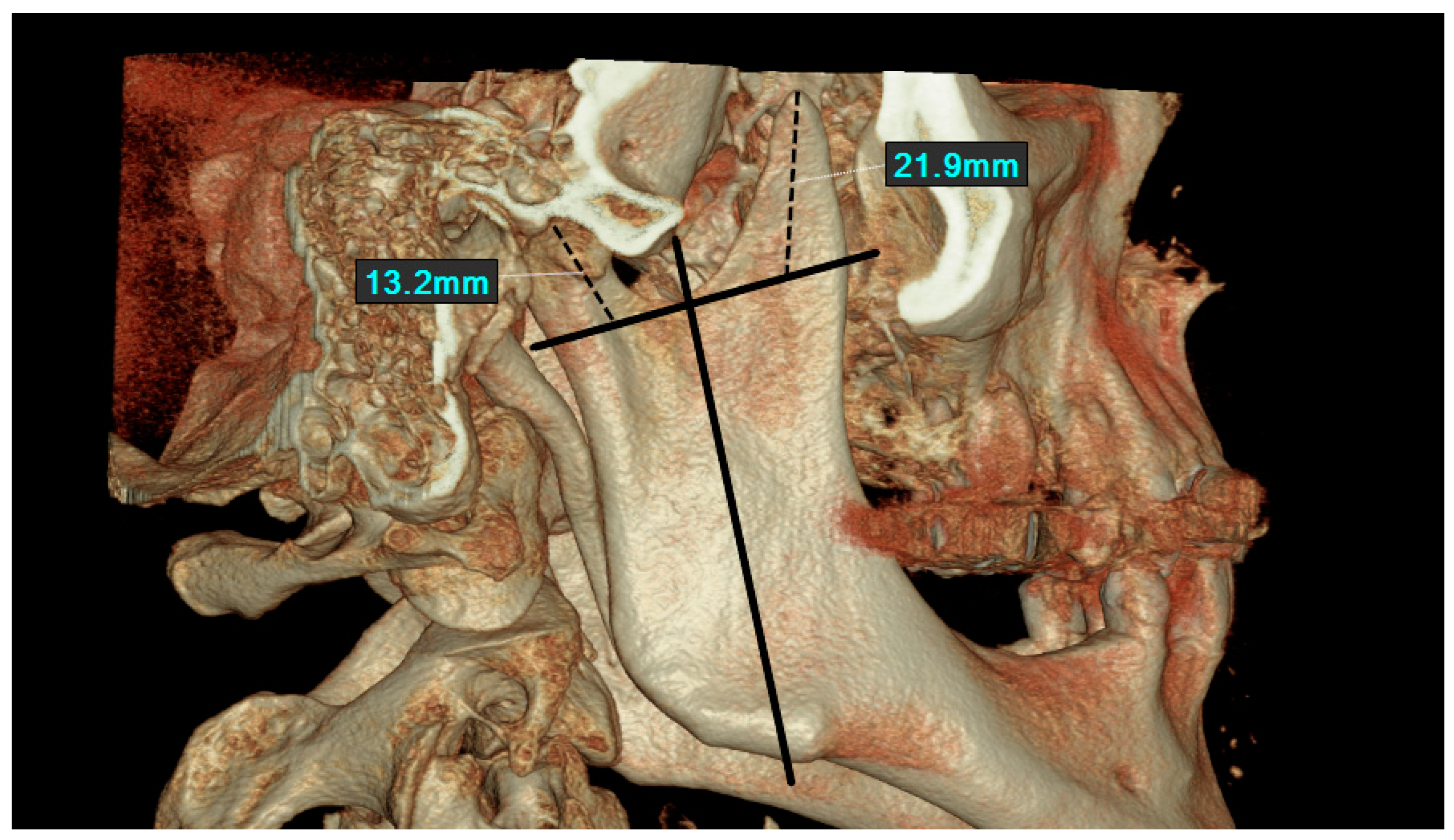 Jcm 14 01623 g001 Jcm 14 01623 g001