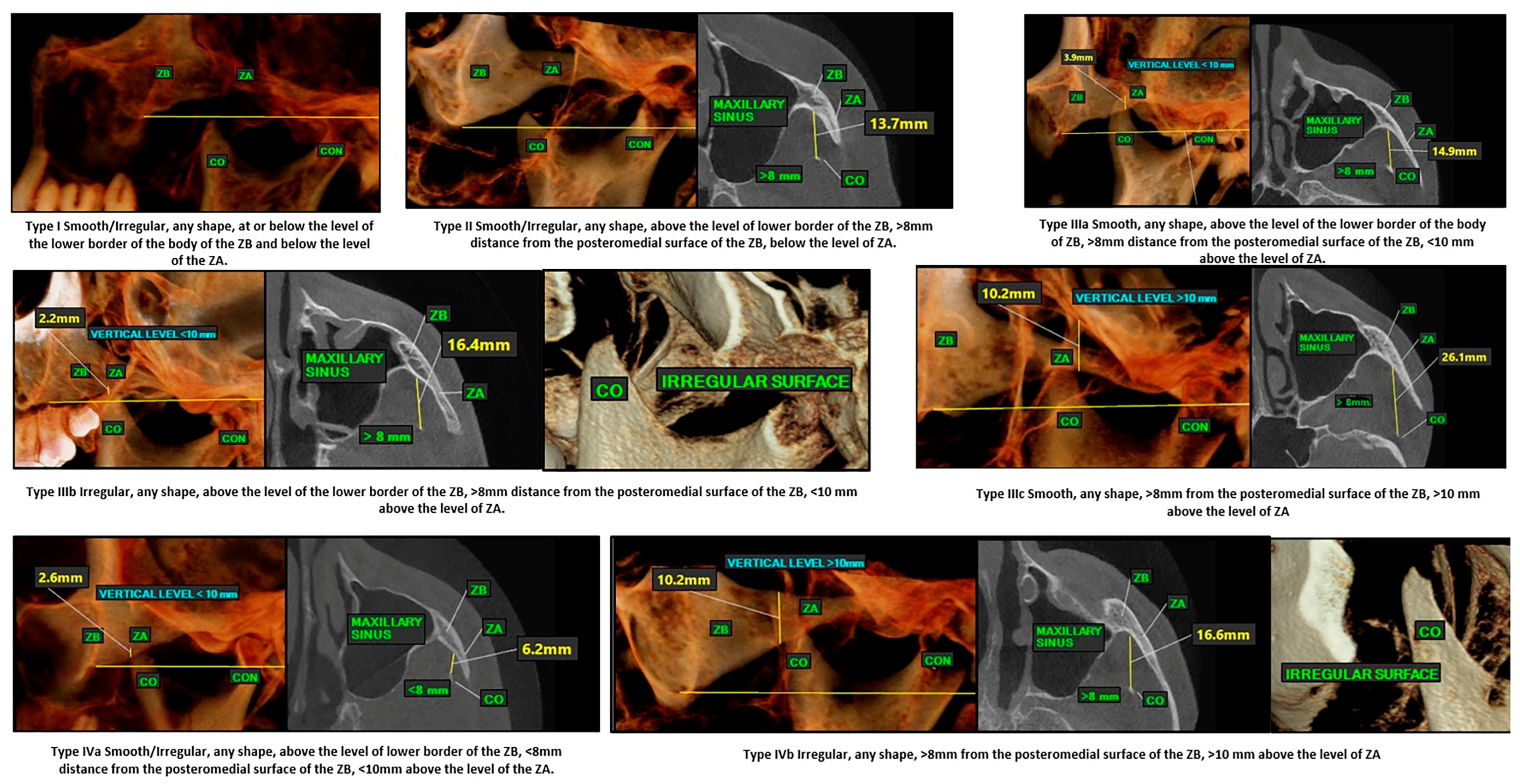 Jcm 14 01623 g005 Jcm 14 01623 g005