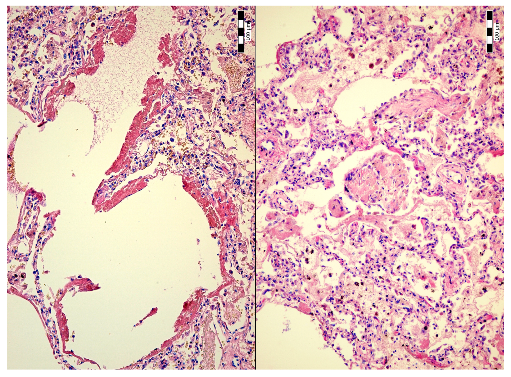 Jcm 14 01871 g003 Jcm 14 01871 g003