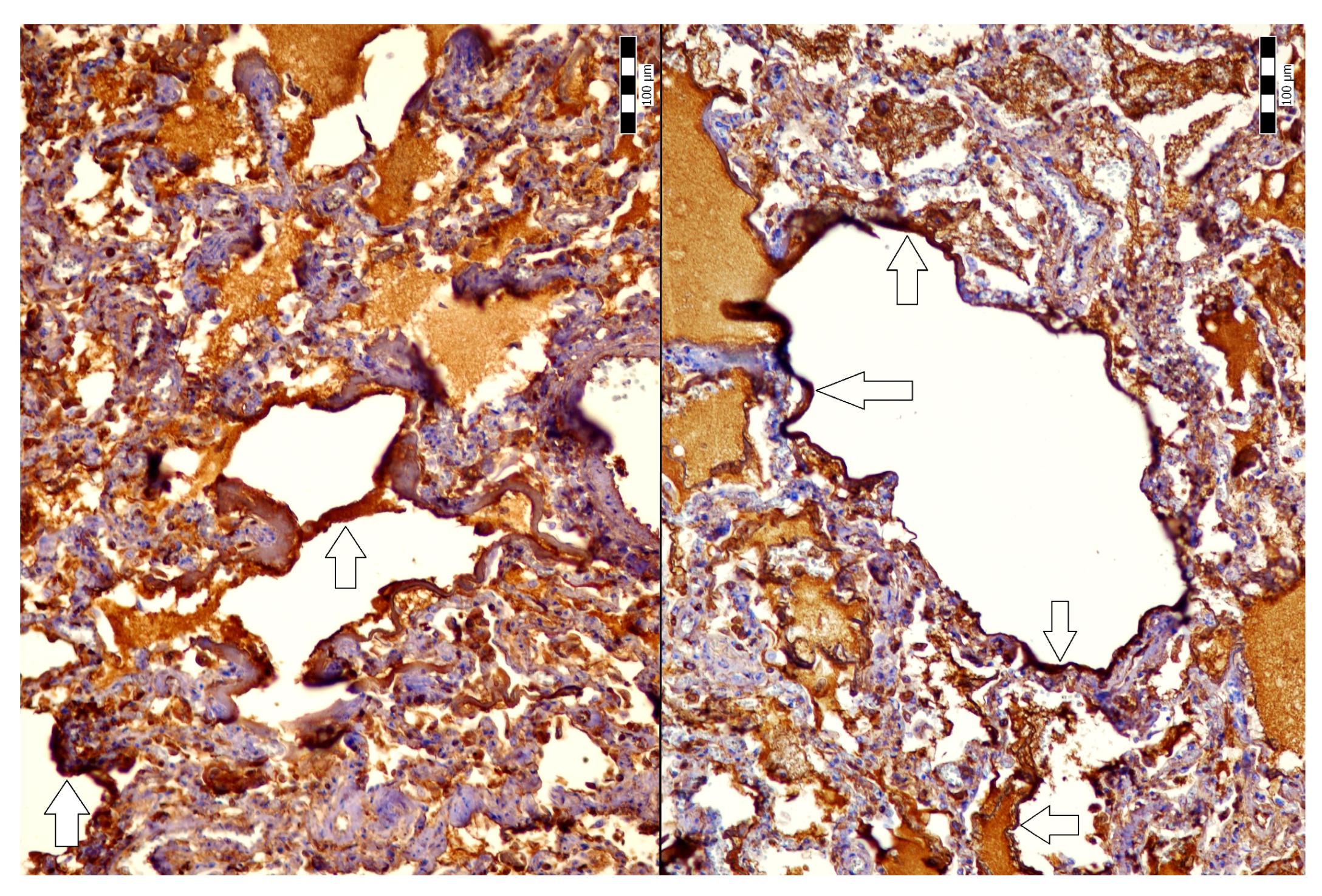 Jcm 14 01871 g004 Jcm 14 01871 g004