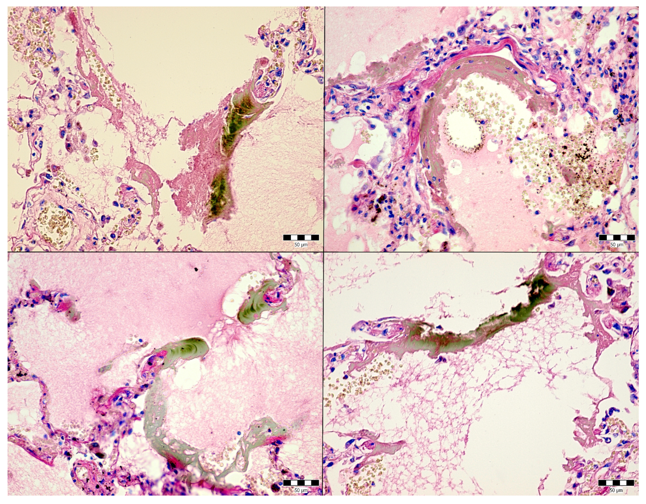 Jcm 14 01871 g005 Jcm 14 01871 g005