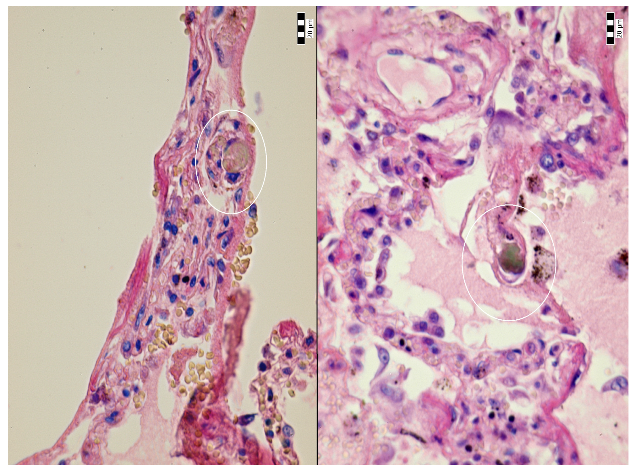 Jcm 14 01871 g008 Jcm 14 01871 g008