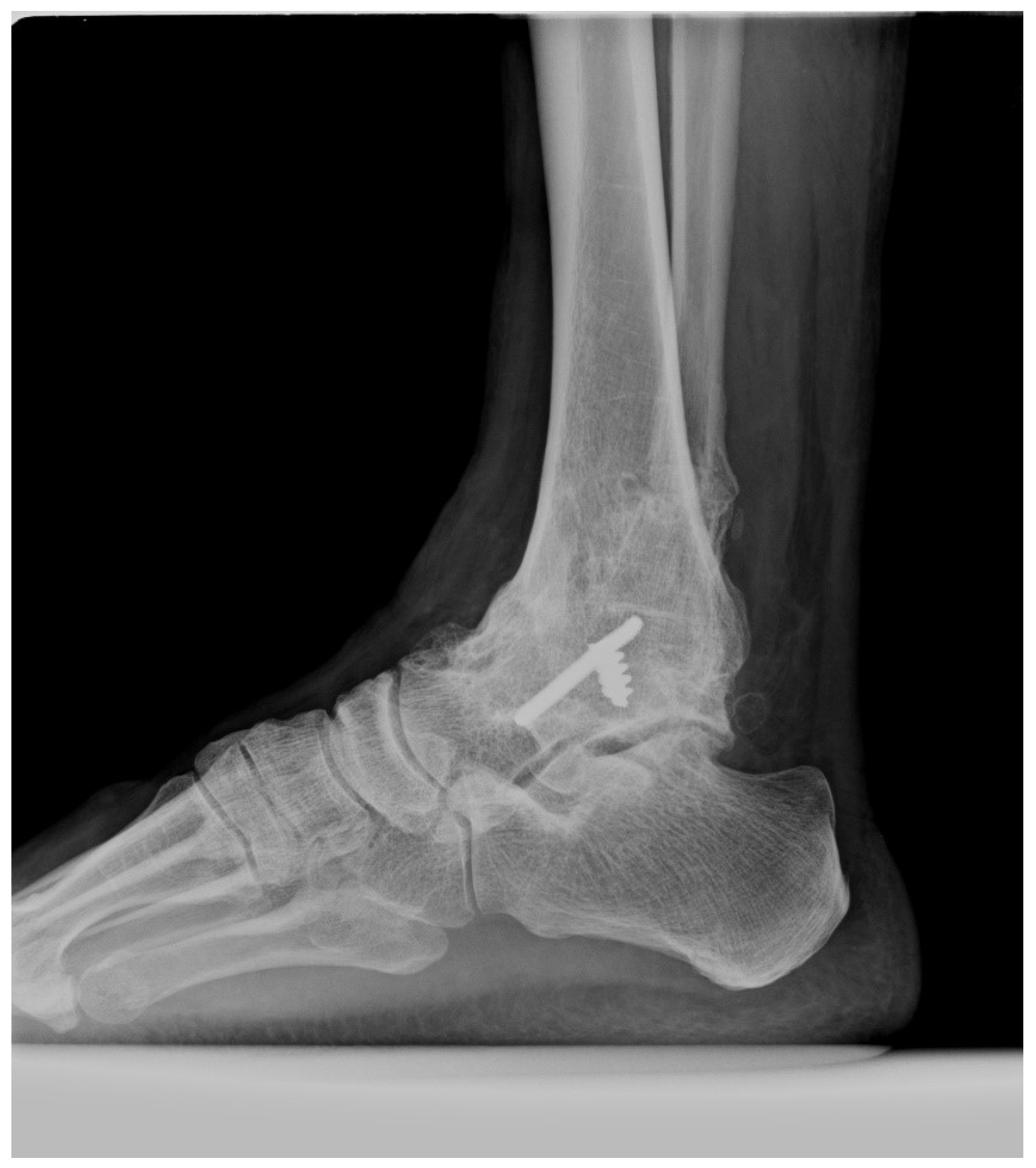 Jcm 14 01887 g005 Jcm 14 01887 g005