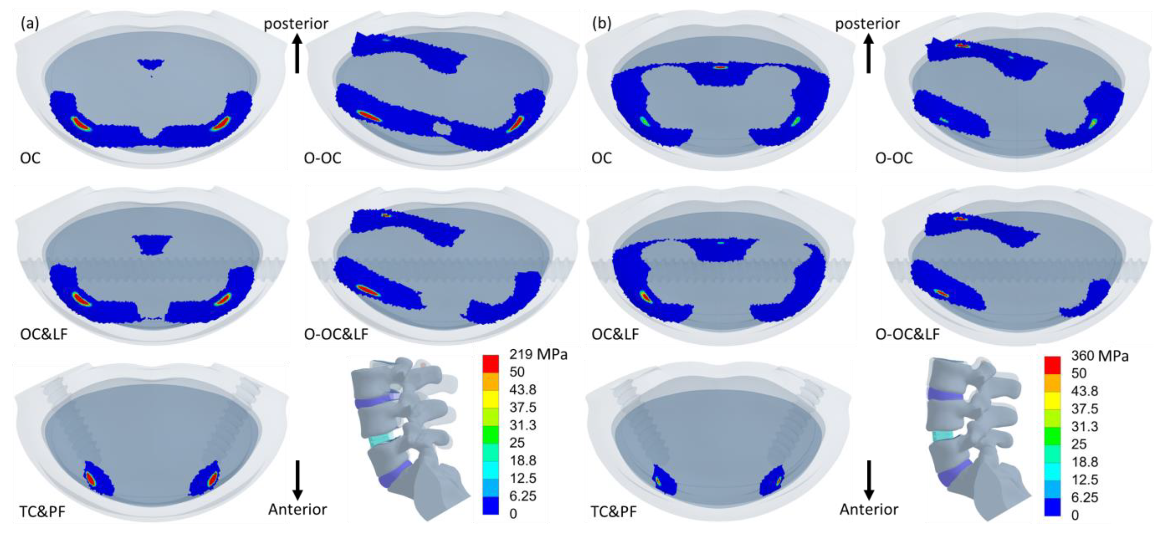 Jcm 14 01890 g009 Jcm 14 01890 g009