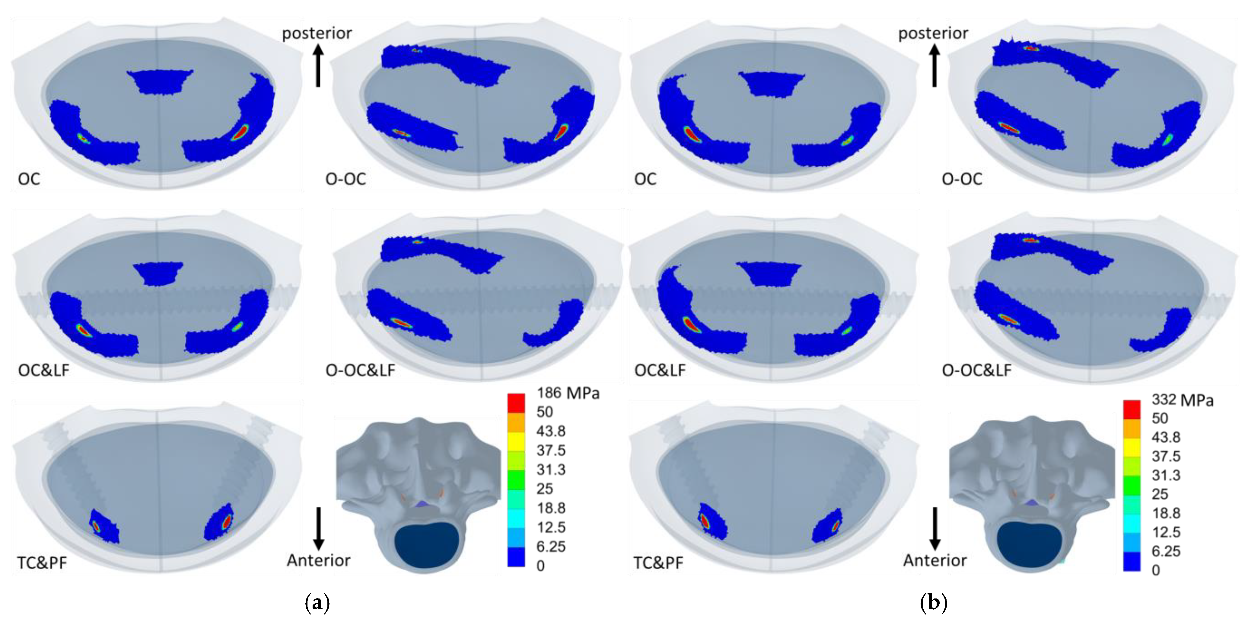 Jcm 14 01890 g011 Jcm 14 01890 g011