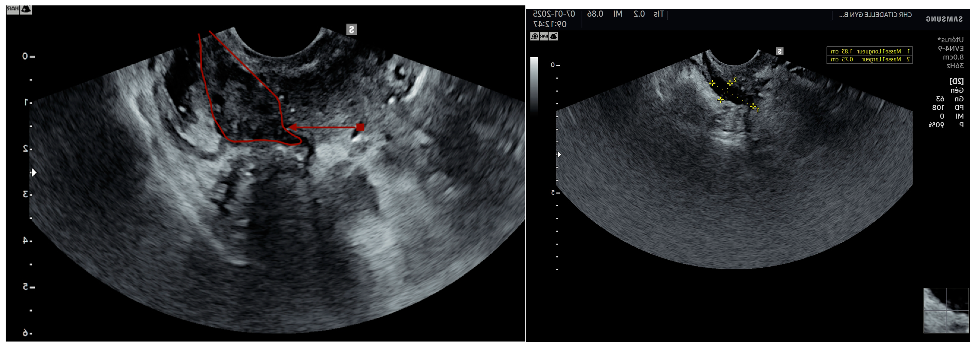 Jcm 14 01904 g003 Jcm 14 01904 g003