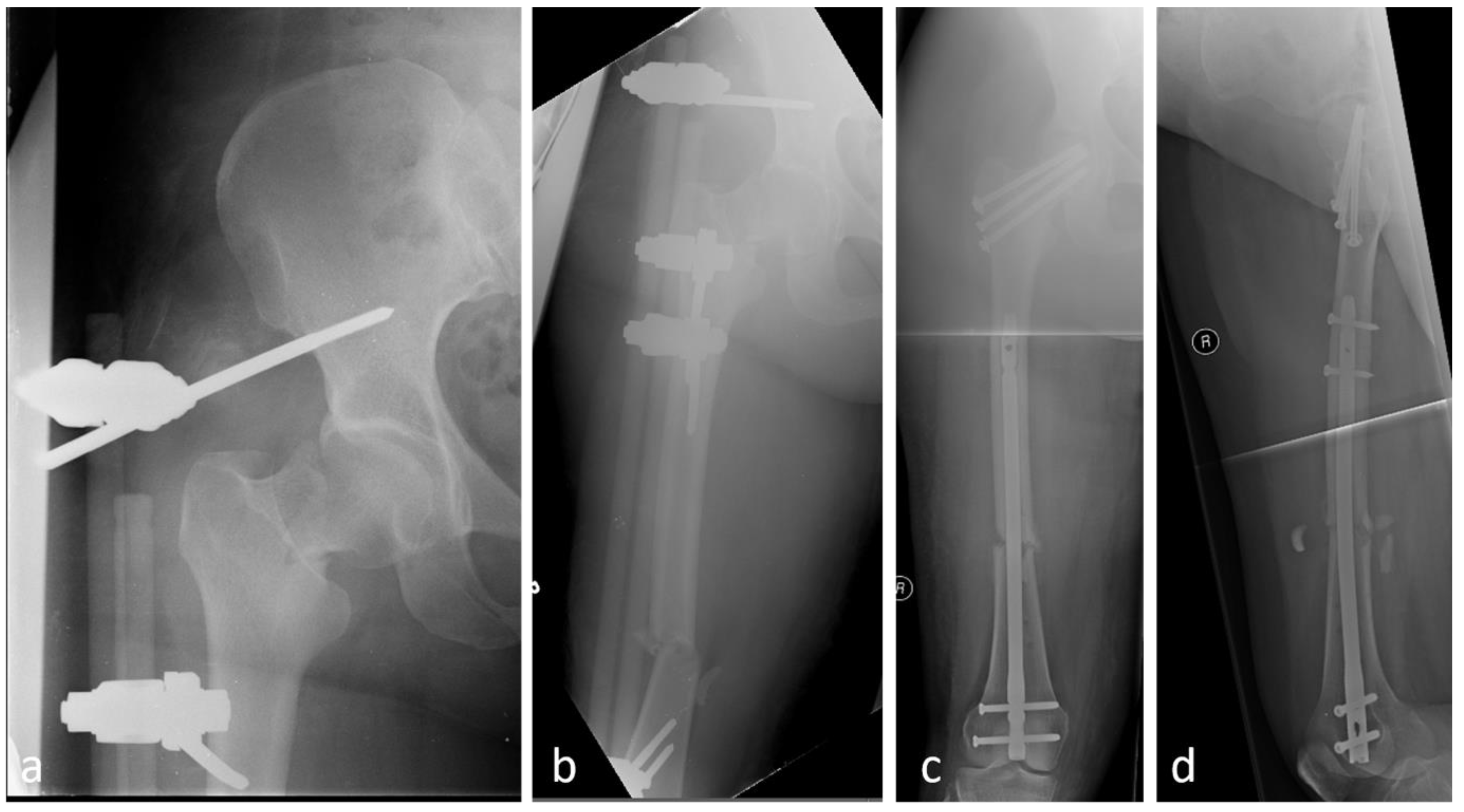 Jcm 14 02200 g002 Jcm 14 02200 g002