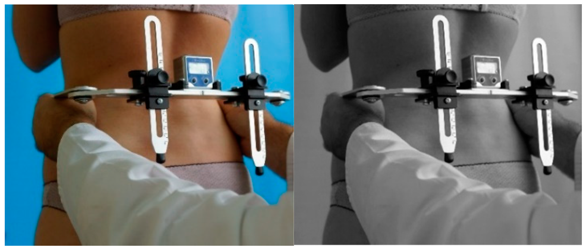 Jcm 14 02229 g001 Jcm 14 02229 g001