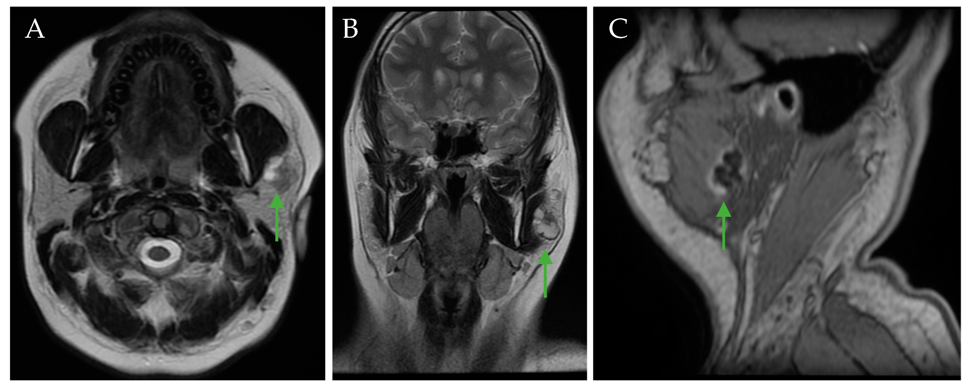 Jcm 14 02290 g003 Jcm 14 02290 g003