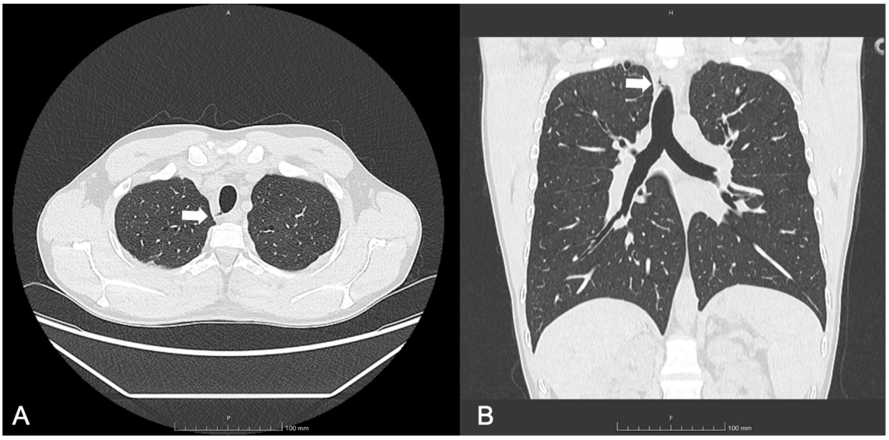 Jcm 14 02320 g001 Jcm 14 02320 g001
