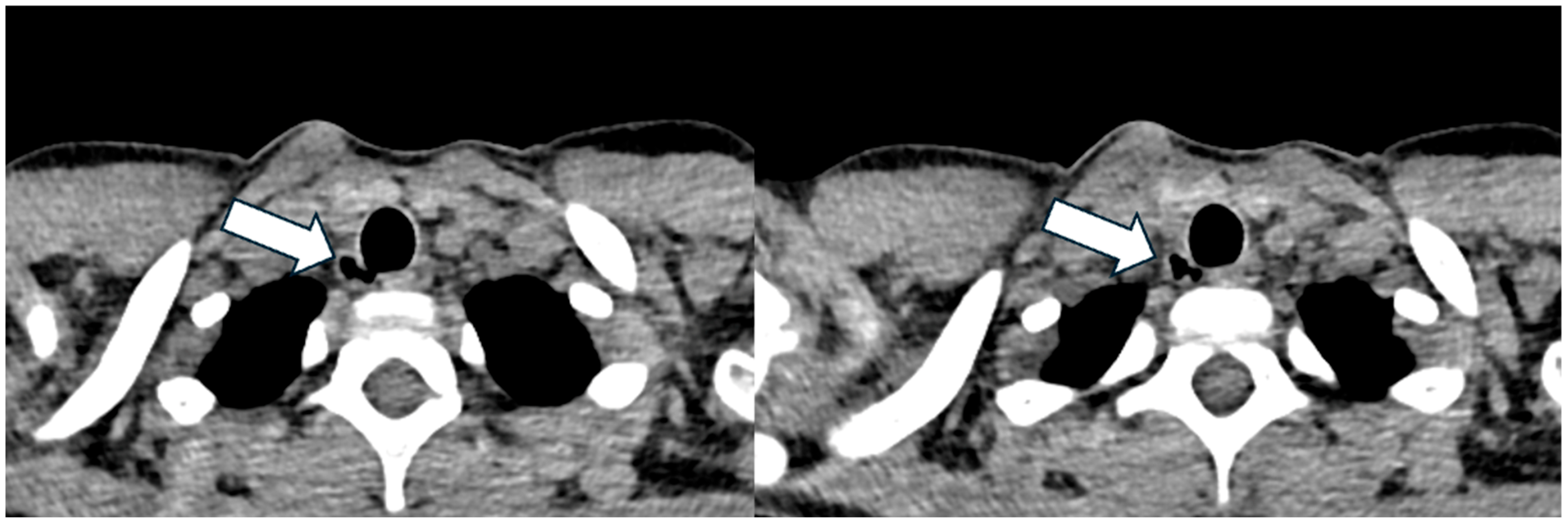 Jcm 14 02320 g004 Jcm 14 02320 g004
