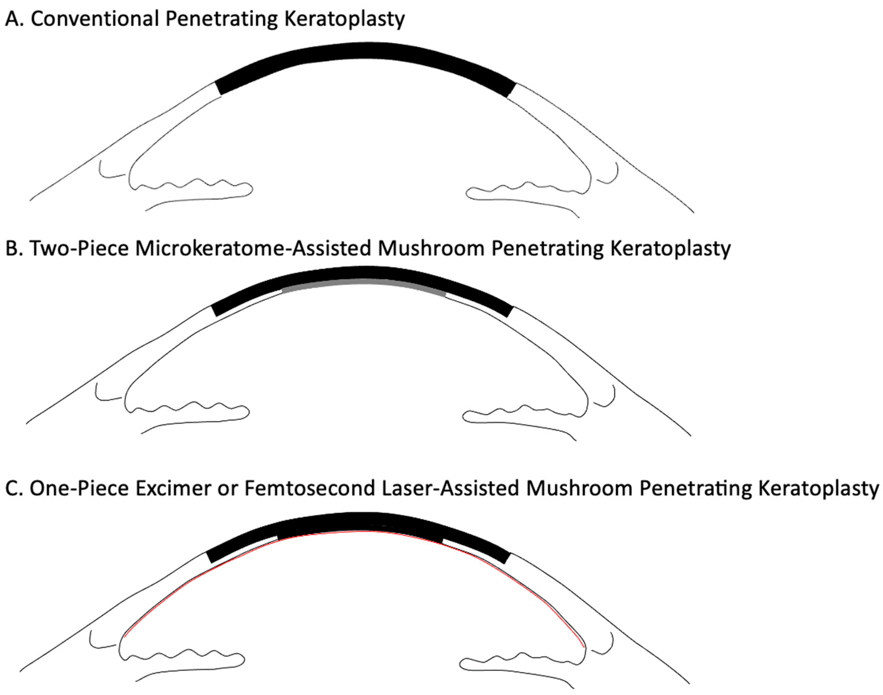 Jcm 14 02351 g001 Jcm 14 02351 g001