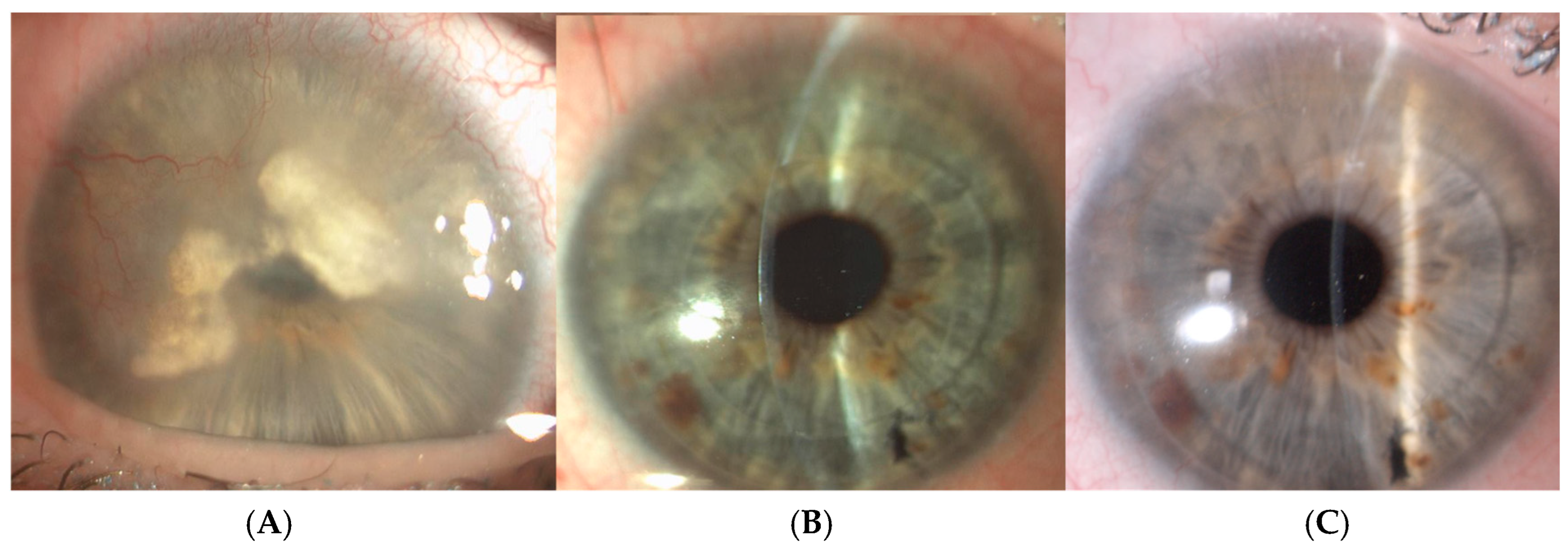 Jcm 14 02351 g002 Jcm 14 02351 g002