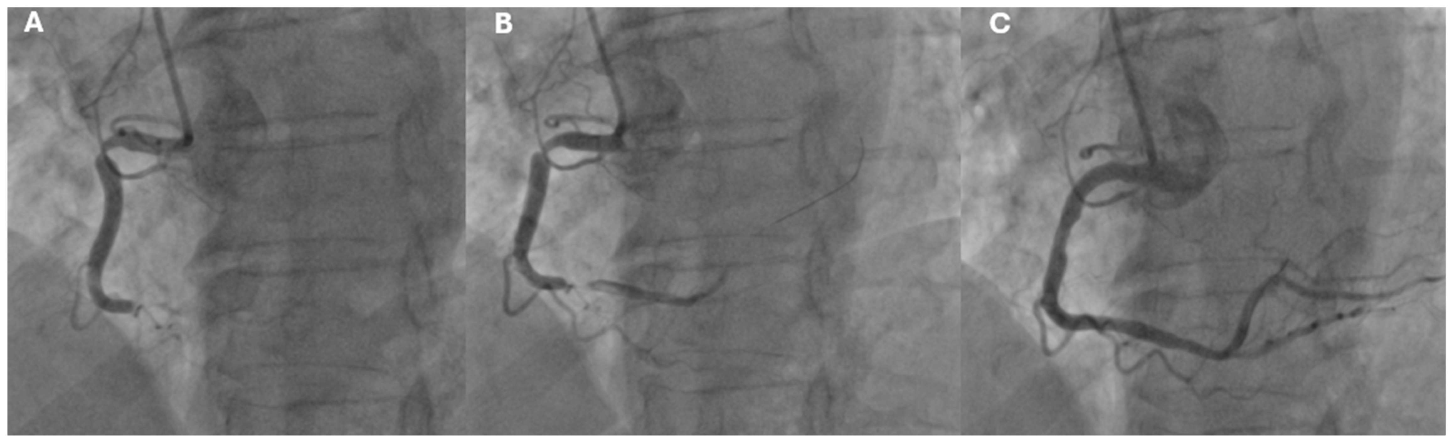 Jcm 14 02354 g004 Jcm 14 02354 g004