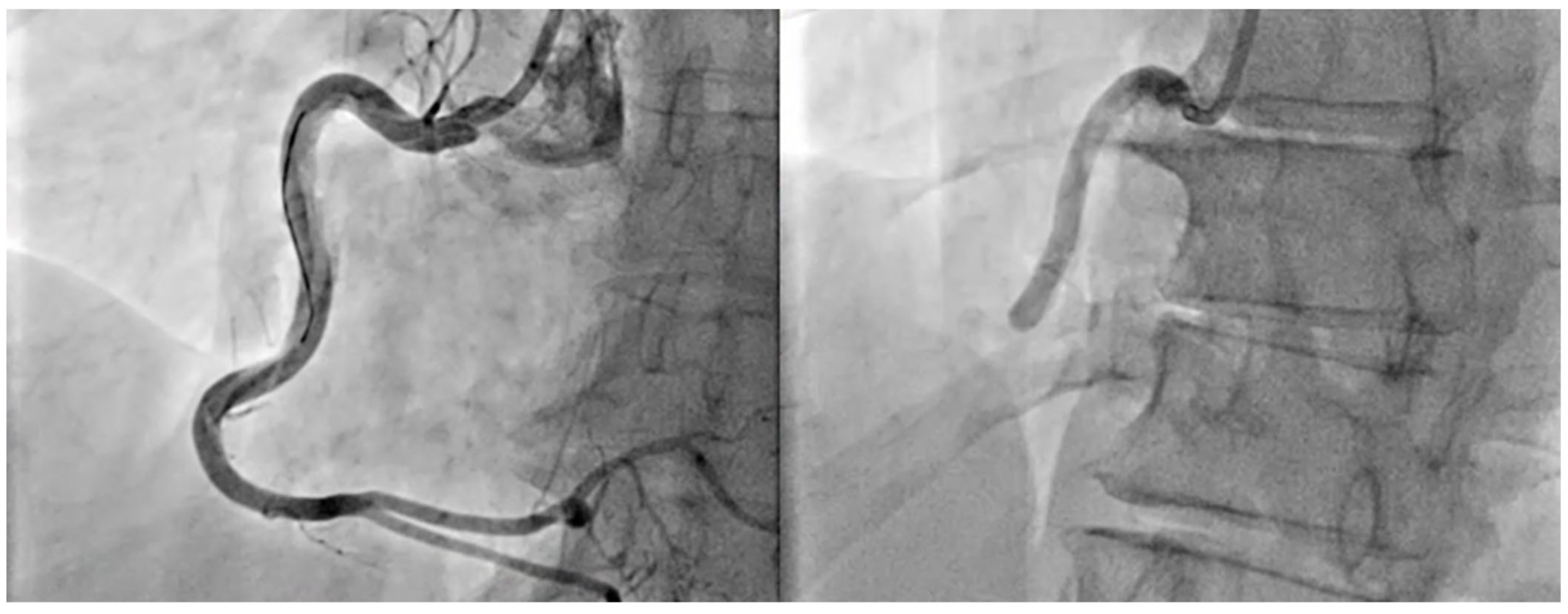 Jcm 14 02354 g005 Jcm 14 02354 g005