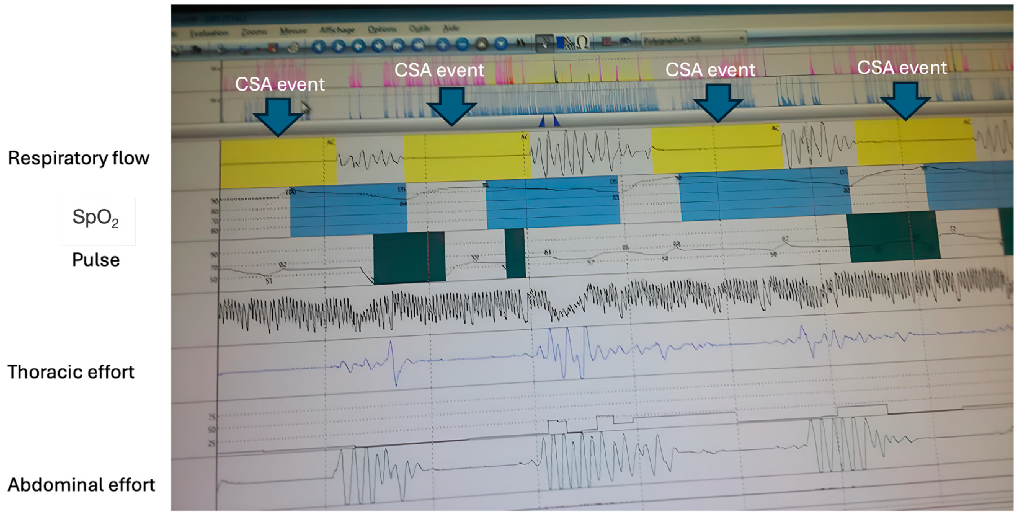 Jcm 14 02369 g002 Jcm 14 02369 g002