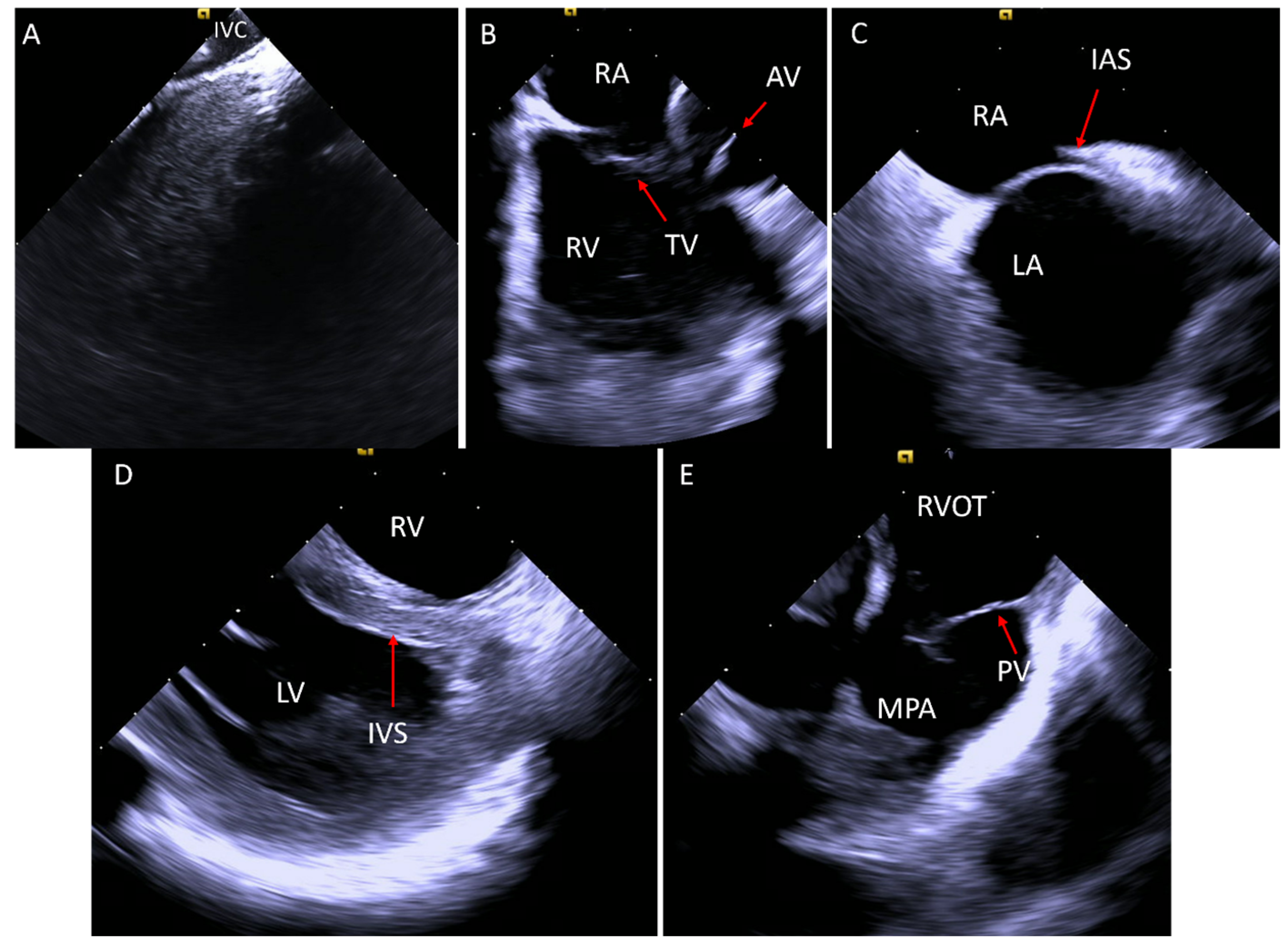 Jcm 14 02414 g001 Jcm 14 02414 g001