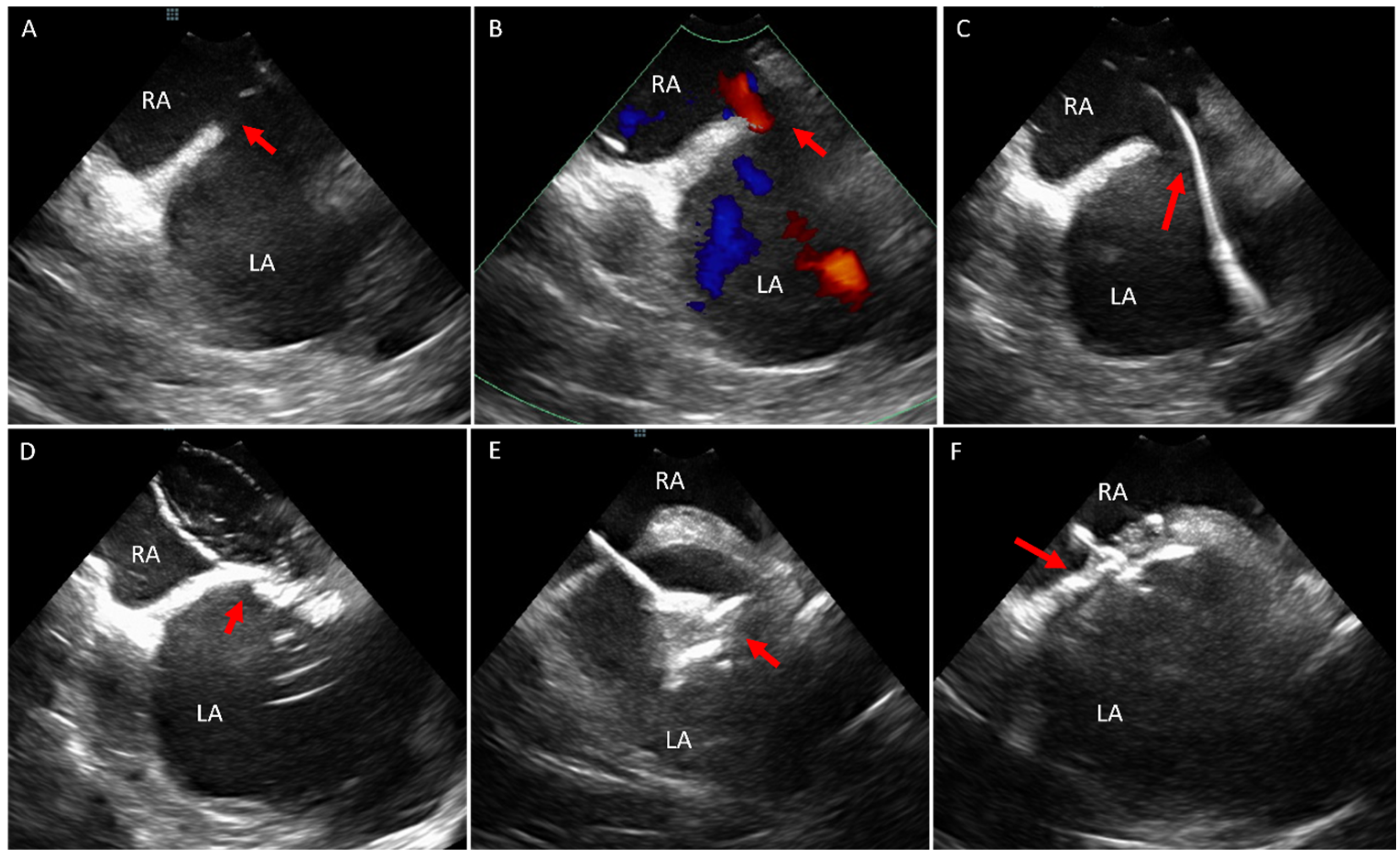 Jcm 14 02414 g002 Jcm 14 02414 g002