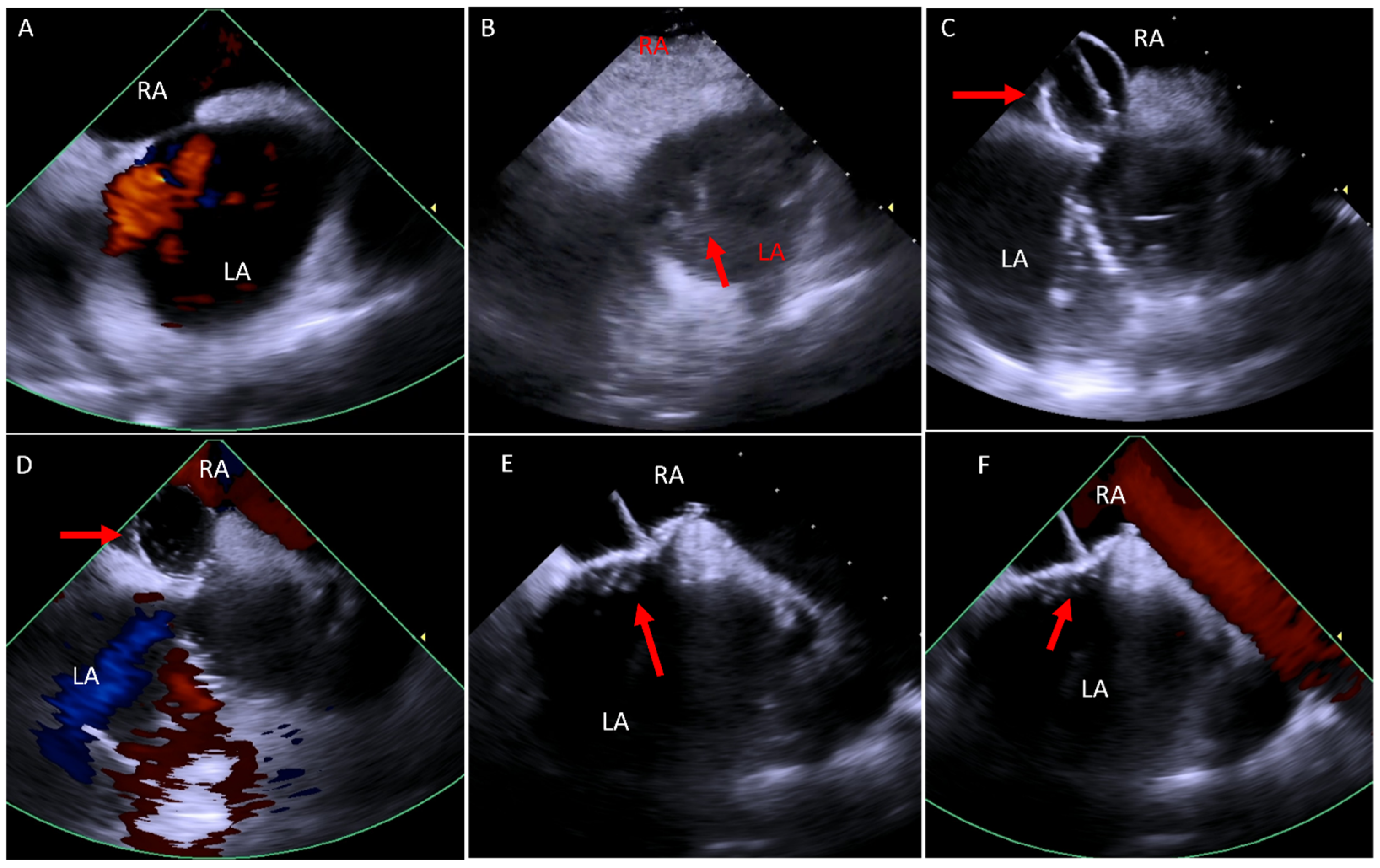 Jcm 14 02414 g004 Jcm 14 02414 g004