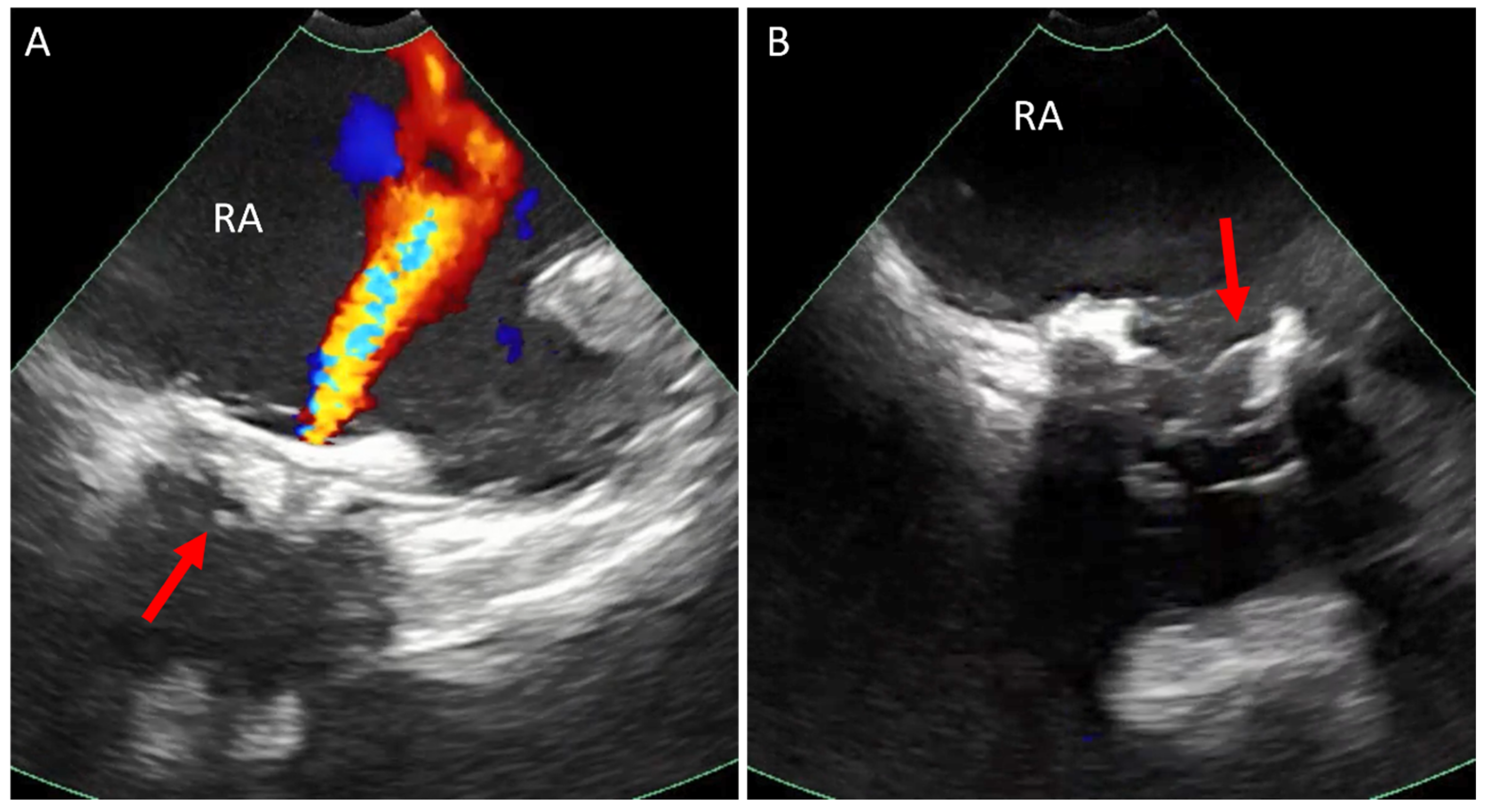 Jcm 14 02414 g007 Jcm 14 02414 g007