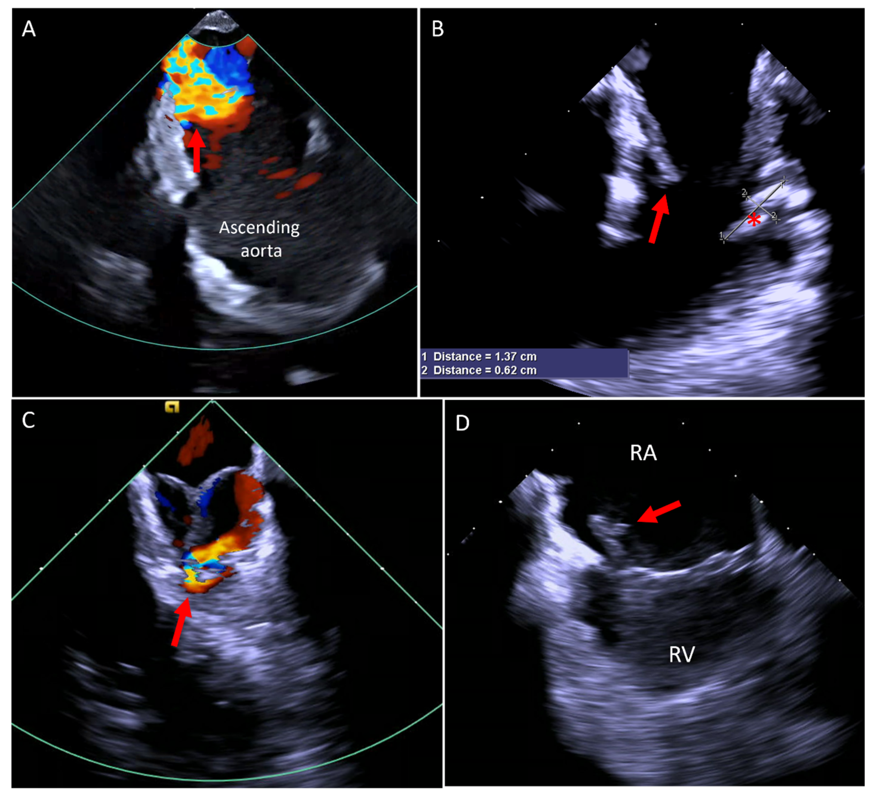 Jcm 14 02414 g009 Jcm 14 02414 g009
