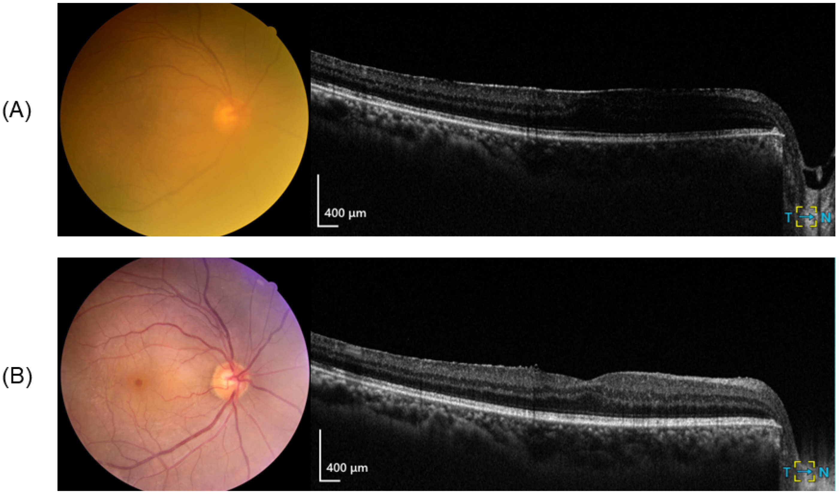 Jcm 14 02423 g001 Jcm 14 02423 g001