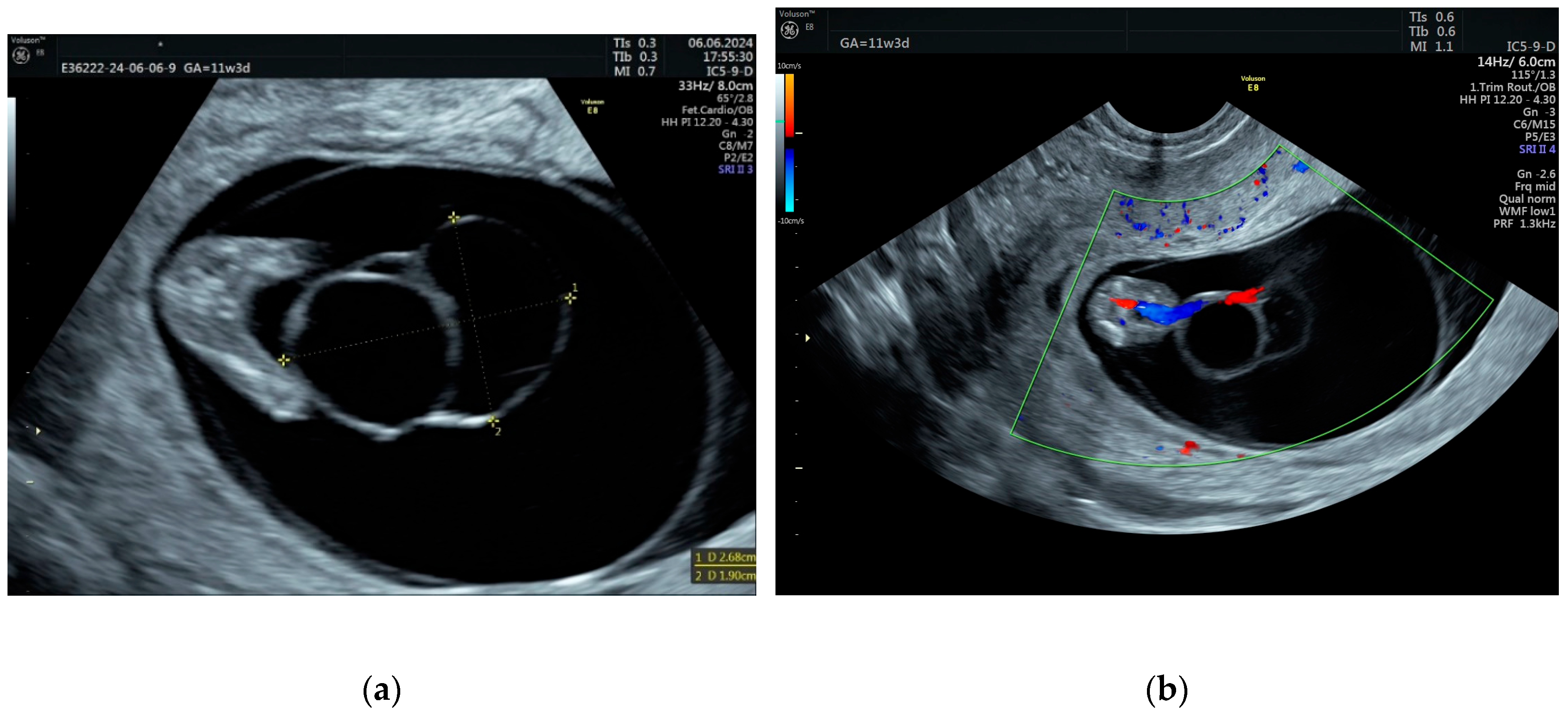 Jcm 14 02564 g002 Jcm 14 02564 g002