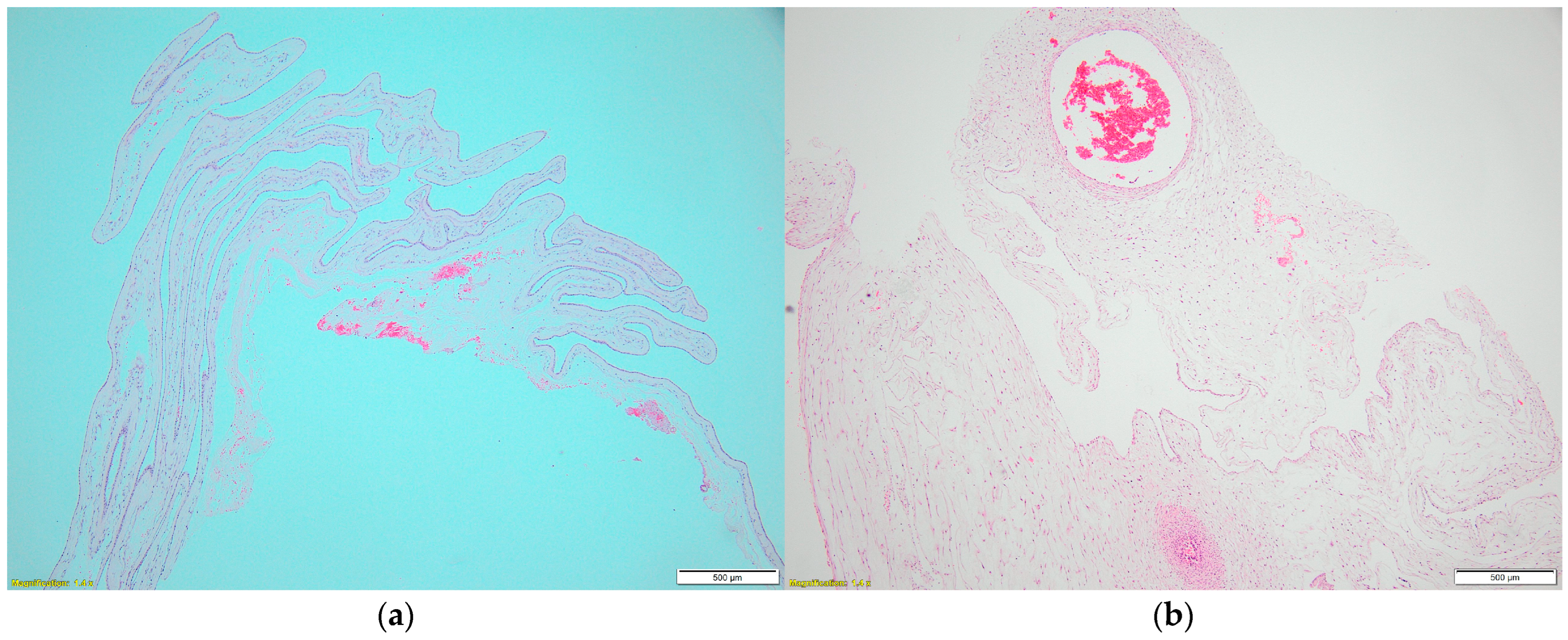 Jcm 14 02564 g003 Jcm 14 02564 g003
