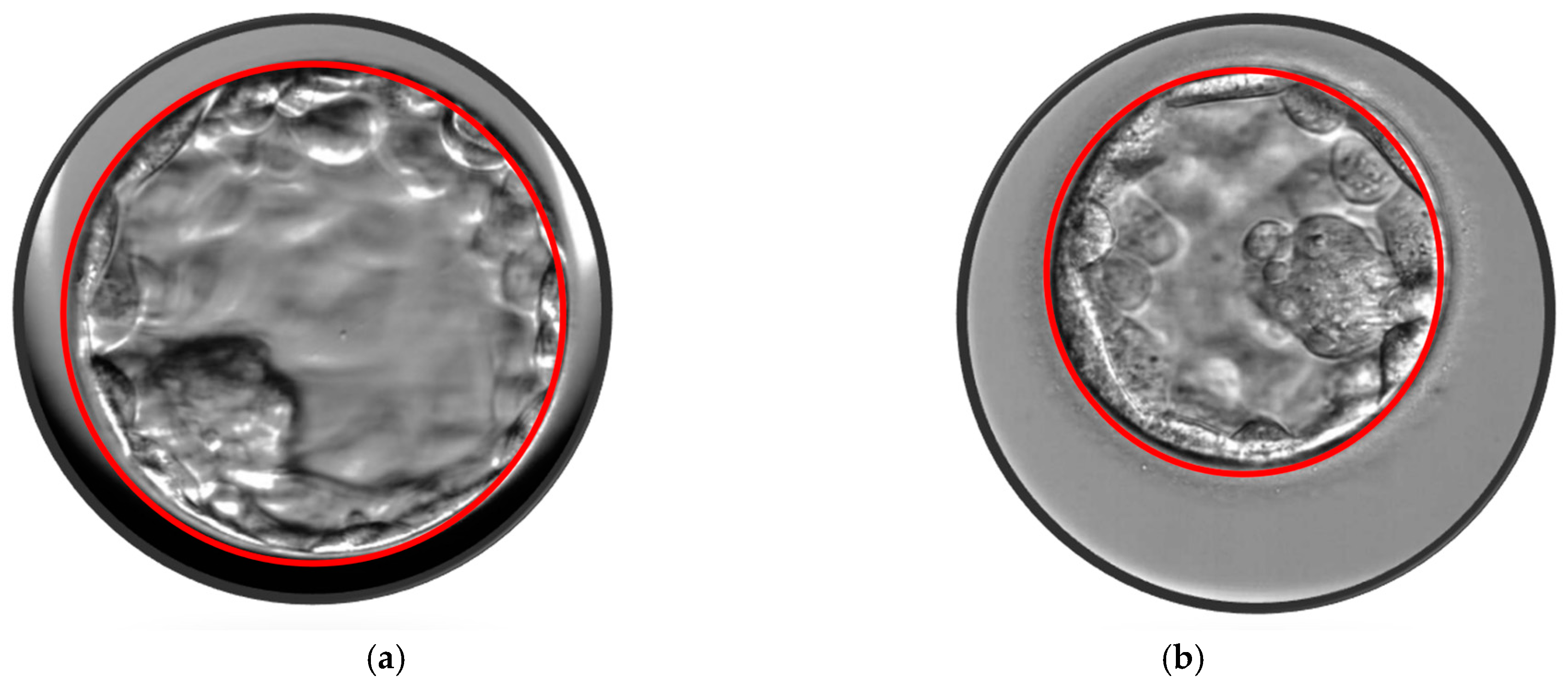 Jcm 14 02827 g001 Jcm 14 02827 g001