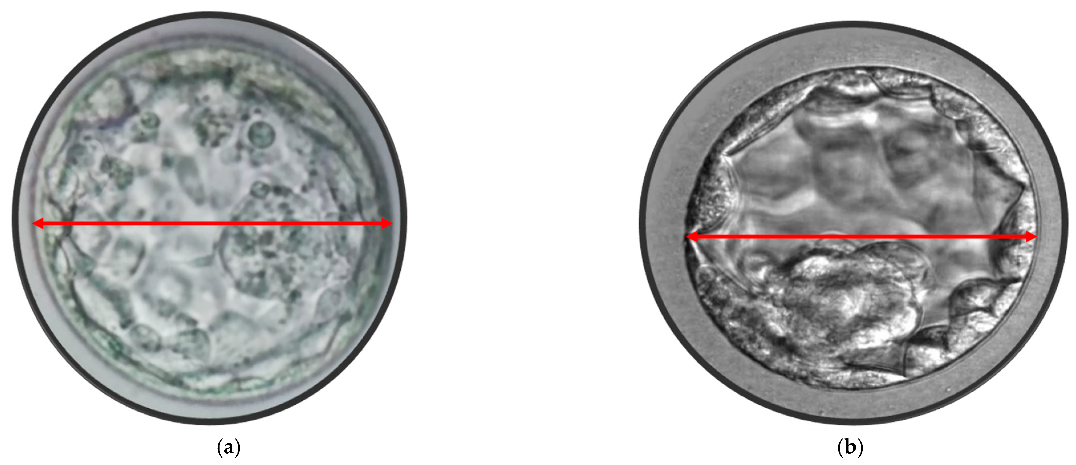 Jcm 14 02827 g002 Jcm 14 02827 g002