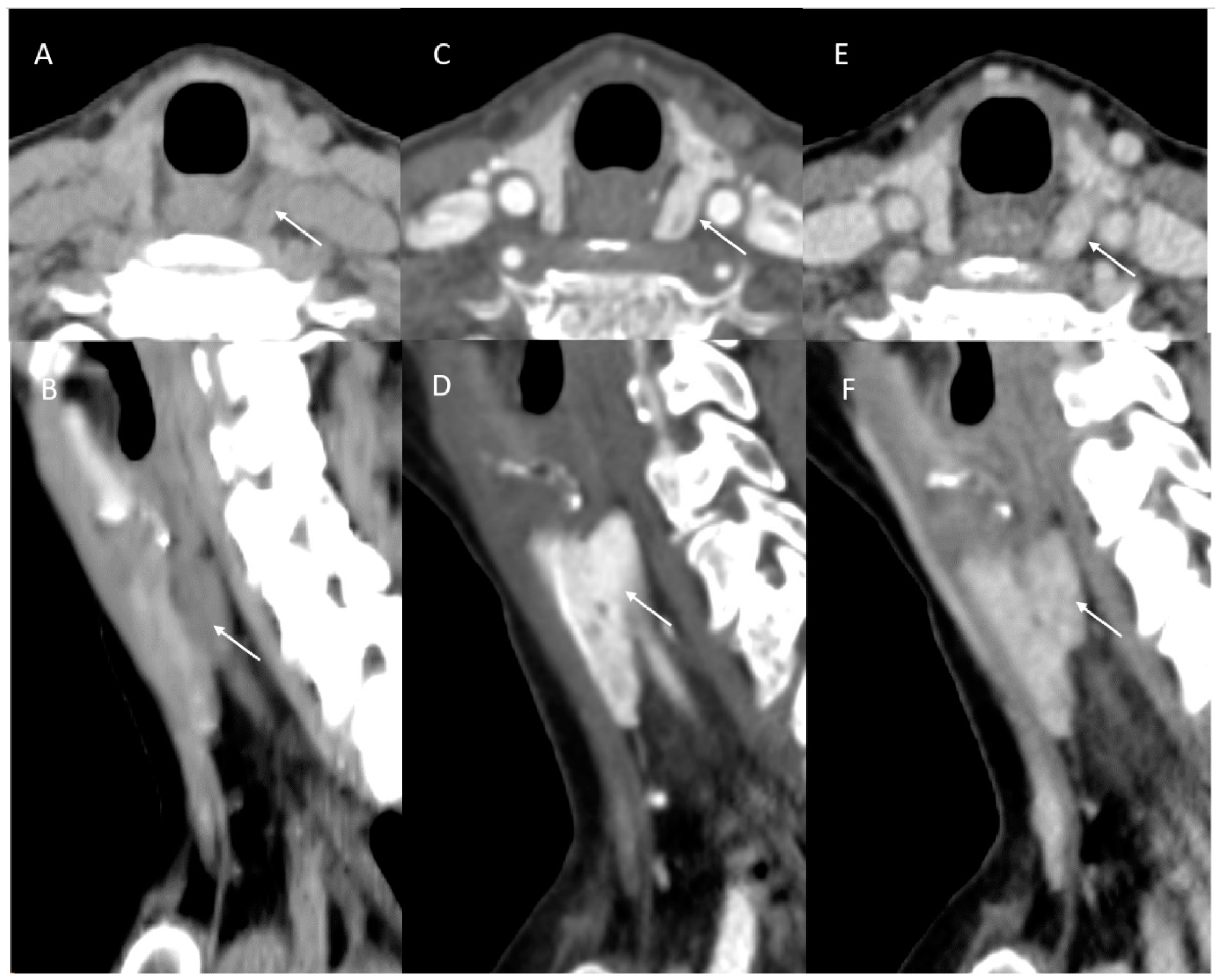Jcm 14 02865 g002 Jcm 14 02865 g002