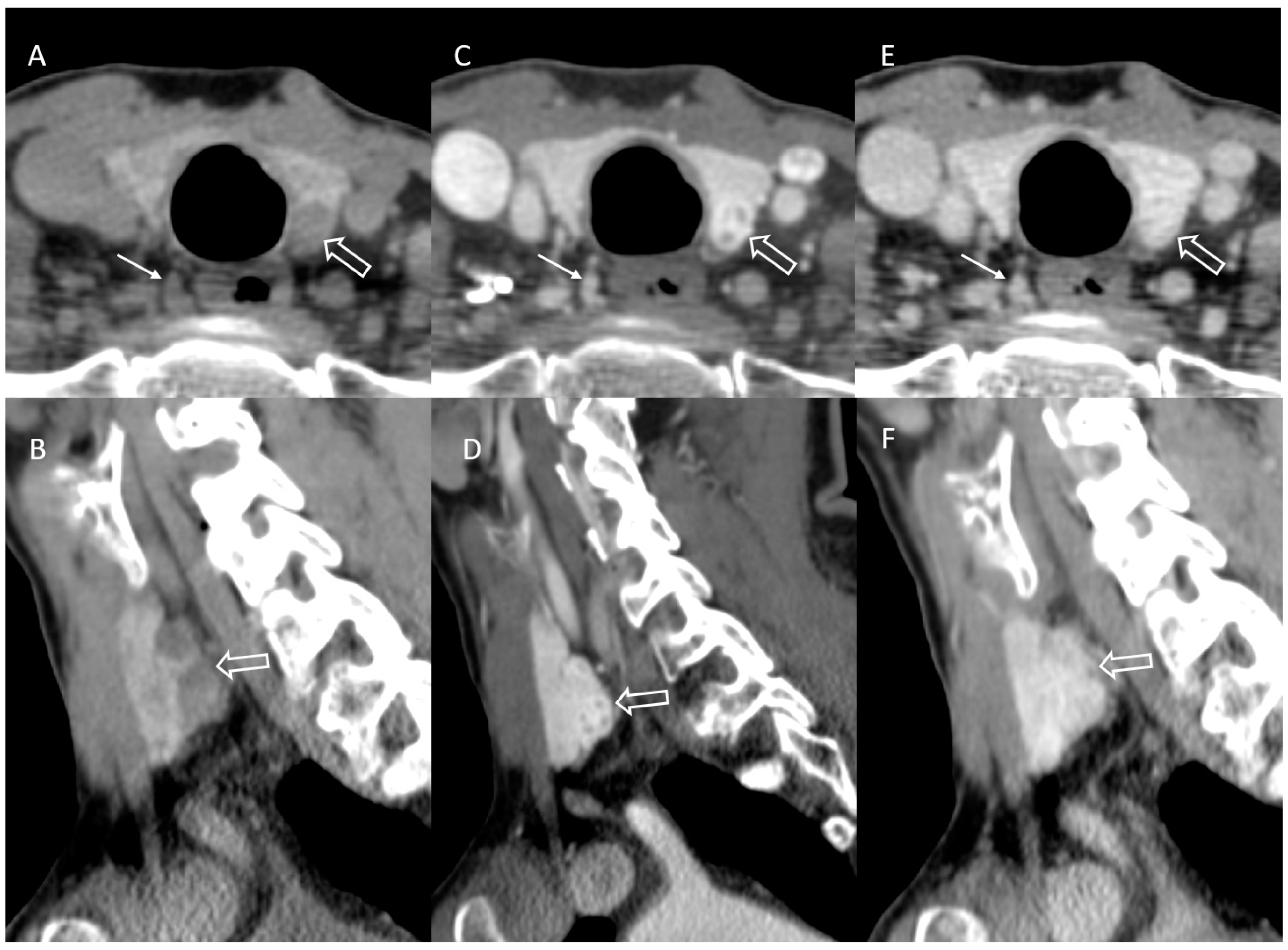 Jcm 14 02865 g003 Jcm 14 02865 g003