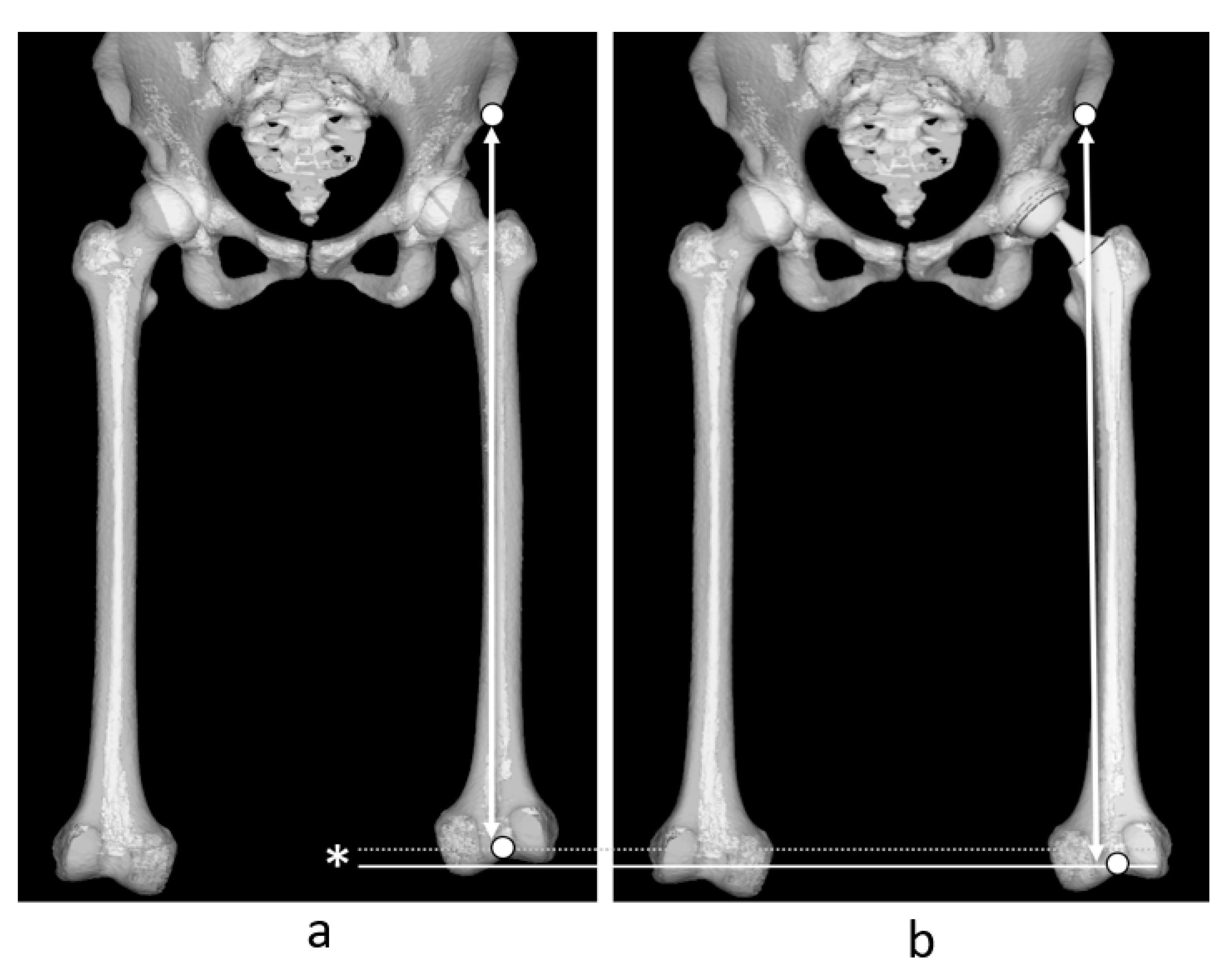 ORTHEX Large Bone Circular Fixator - OrthoPediatrics