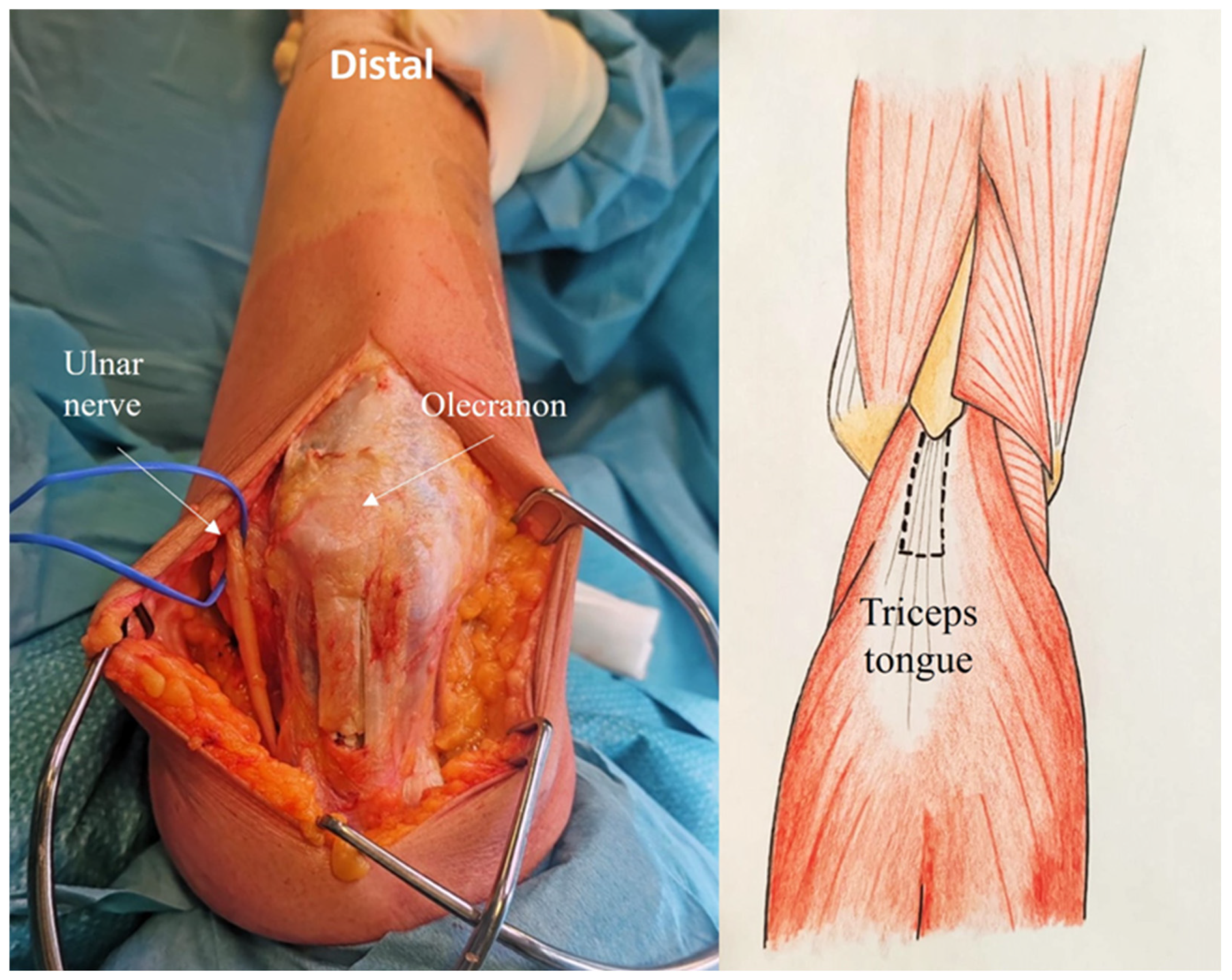 Jcm 14 02901 g002 Jcm 14 02901 g002