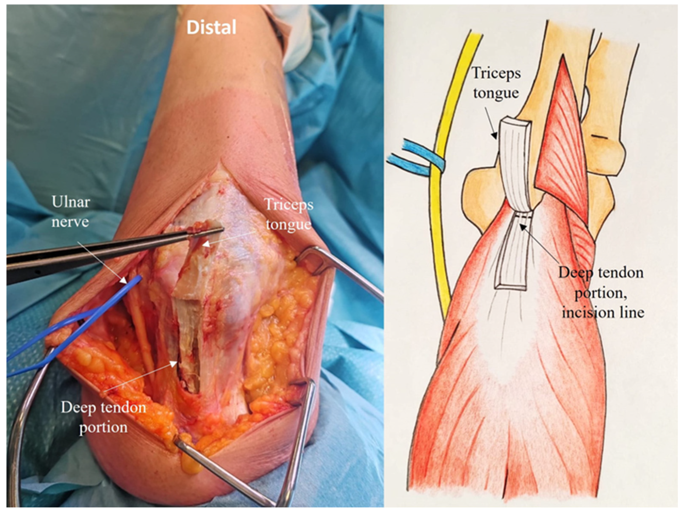 Jcm 14 02901 g003 Jcm 14 02901 g003