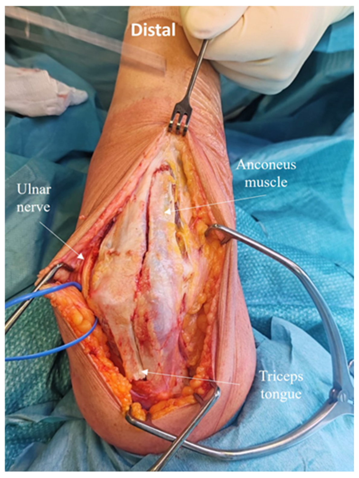 Jcm 14 02901 g004 Jcm 14 02901 g004