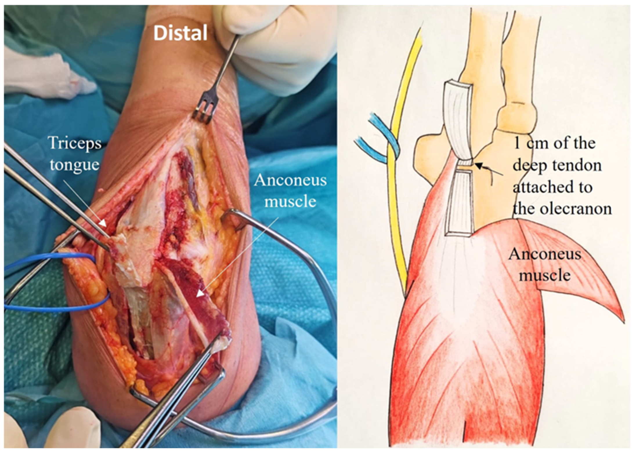 Jcm 14 02901 g005 Jcm 14 02901 g005