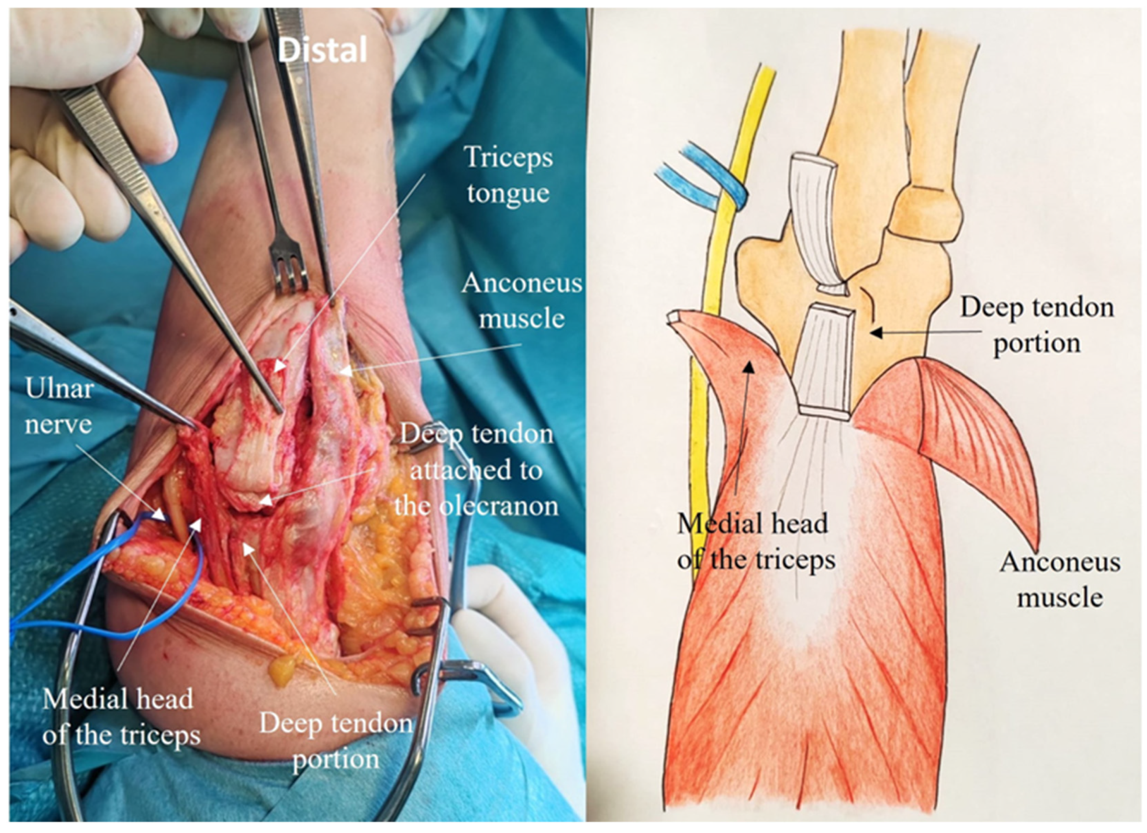Jcm 14 02901 g006 Jcm 14 02901 g006