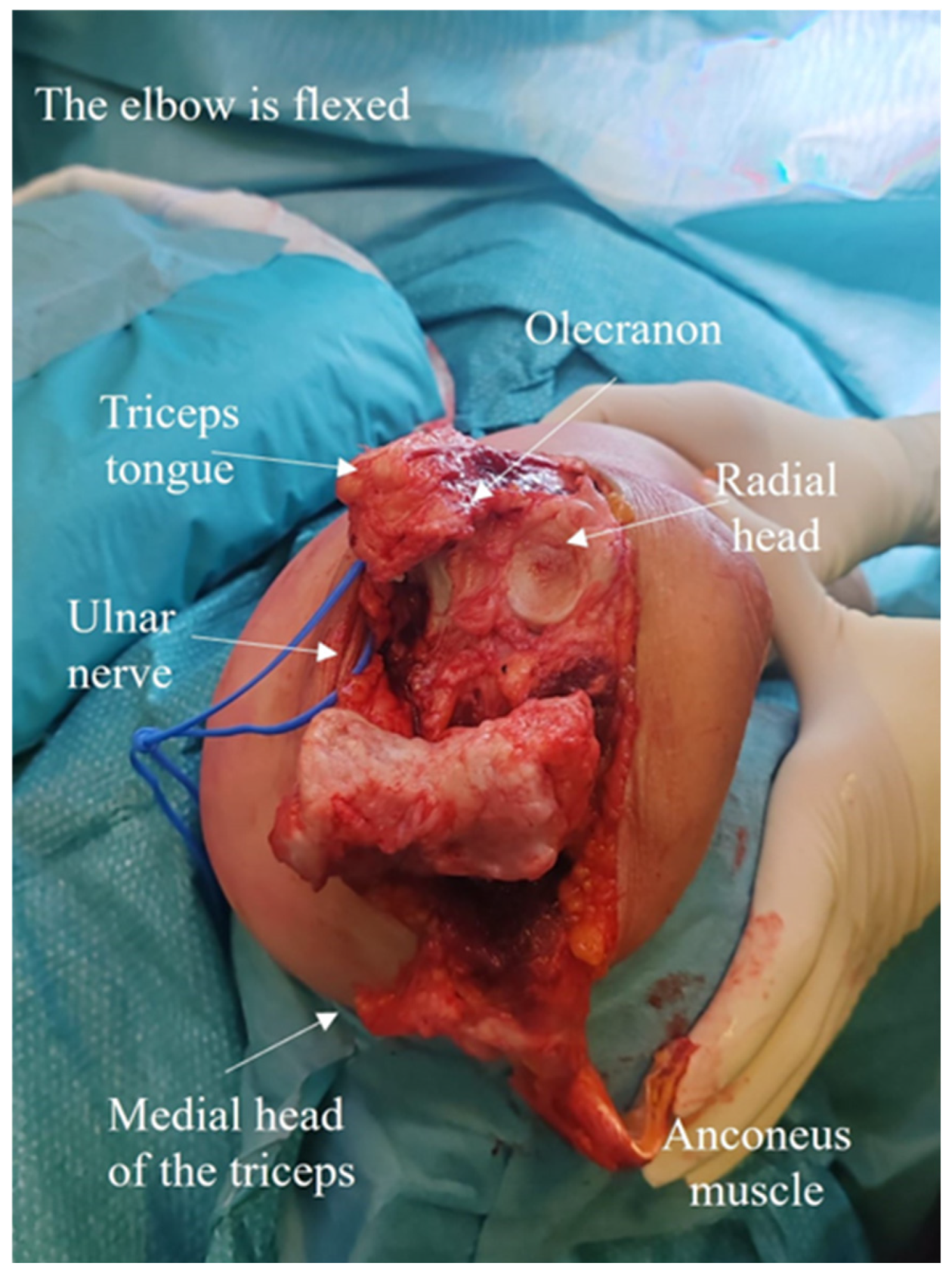 Jcm 14 02901 g007 Jcm 14 02901 g007