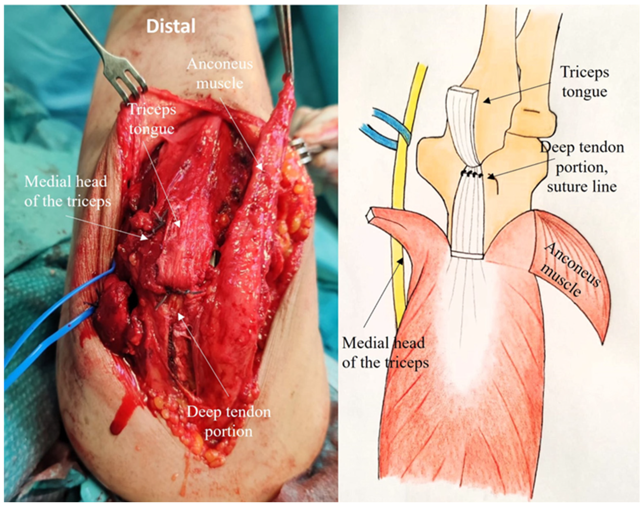 Jcm 14 02901 g008 Jcm 14 02901 g008