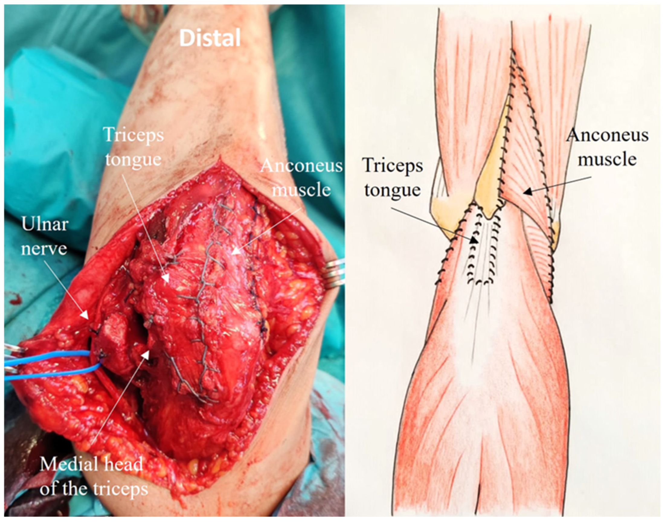 Jcm 14 02901 g009 Jcm 14 02901 g009