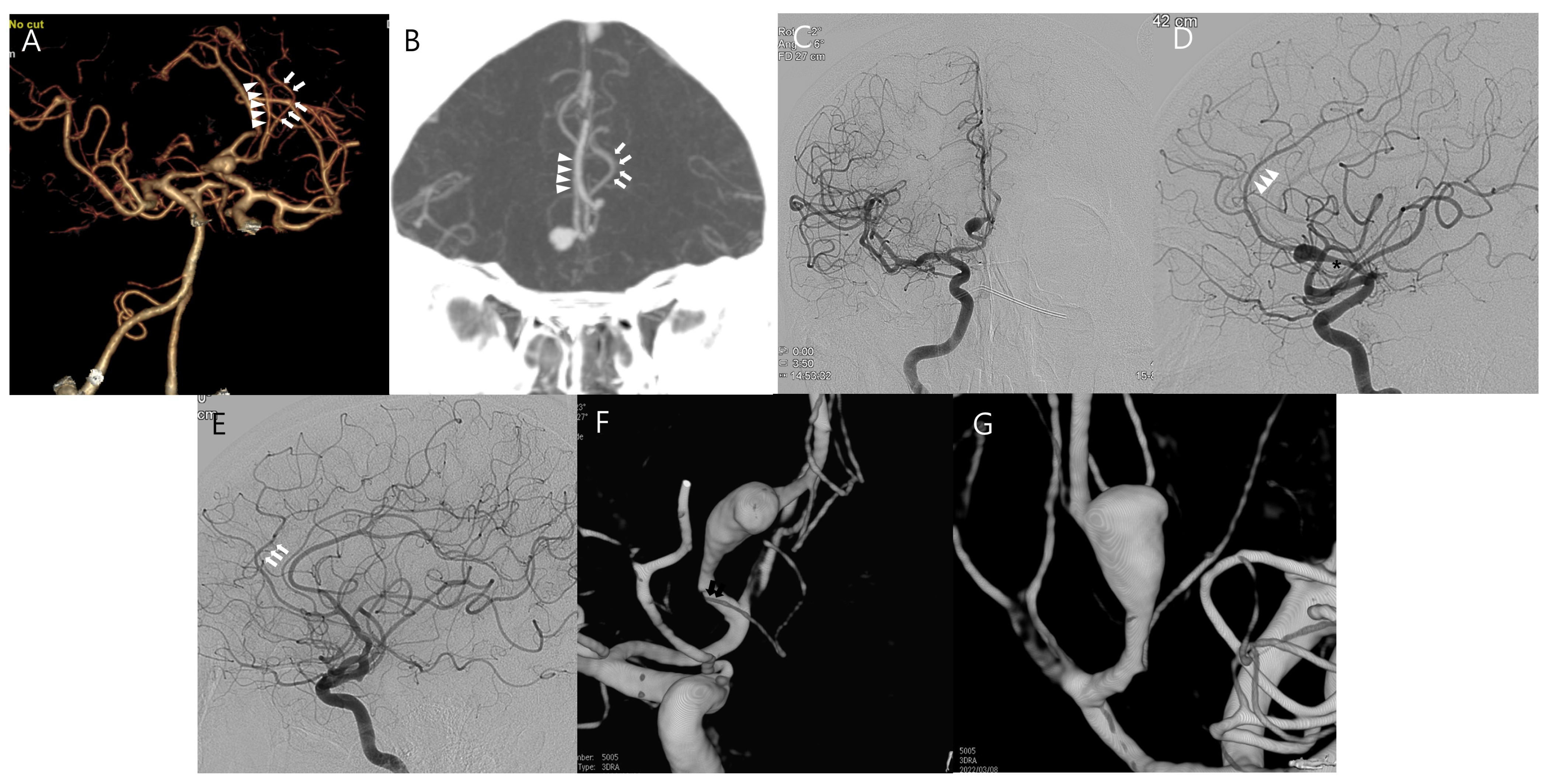 Jcm 14 02927 g001 Jcm 14 02927 g001