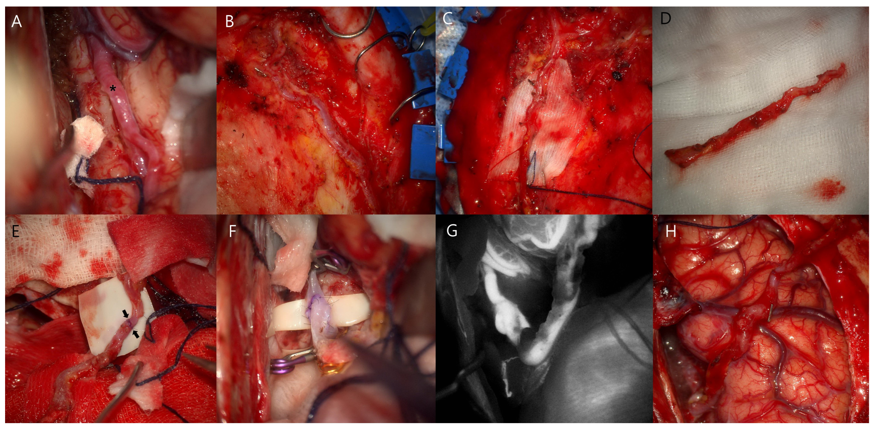 Jcm 14 02927 g002 Jcm 14 02927 g002